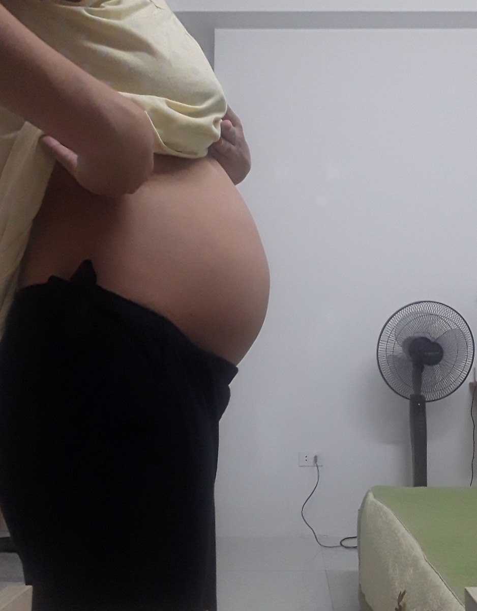 Các mom ơi.
E thai 29w1d hnay. Mà bụng e như vậy có bé k nhỉ?. Bé có nhỏ quá k ạ?
Hôm 27w4d bé mới đc 924g thôi.
E lo quá. Dks 24.11 
Có mom nào cùng giai đoạn tâm sự đi ạ