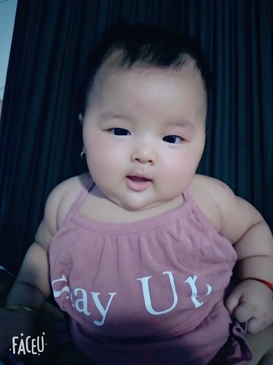 REVIEW VBAC SINH THƯỜNG SAU SINH MỔ THÀNH CÔNG CHO CÁC MOM CÓ ĐỘNG LỰC NHÉ

Em sinh mổ bé đầu tháng 2/2018, thì e bị vỡ kế hoạch khi bé đầu mới 20 tháng nên xác đjnhj mổ 100%, nhưng do có vết mổ cũ nên e ko dám ăn uống nhìu sợ con to ảnh hưởng vết mổ. Tới 35w thì xem trên fb thấy tư vấn sinh thường sau sinh mổ ở bv Hùng Vường, nên e tìm hiểu và quyết định lên bv Hùng Vương sinh ( e ở long An) . Chiều 16/6 e đau bụng lâm râm chằng bụng nên đi khám thử ở phòng khám gần nhà thì bsi kêu phải lên bv mổ liền , e có vết mổ cũ sao để tới giờ, nhưng e vẫn còn bình tĩnh lắm về ăn uống , tắm rửa, thay đồ thoa son 🤣 rồi mới đi. Em lên tới bv là 10h khám nở 1p rộng do có vết mổ cũ nên được nhập viện theo dõi kèm theo dặn ko được ăn uống đợi chỉ định của bsi. Tới 3h sáng bsi khám e được 2p vẫn chưa có cơn đau và được tư vấn về nguy cơ sinh thường và mổ, cuối cùng e quyết định theo dõi sinh thường. Tời 6h chiều lại e bắt đầu có cơn gò nhìu khám đc 3p đẩy vào phòng sinh. Lúc này đau có hỏi về việc chích gây tê màng cứng nhưng do có vết mổ cũ nên ko được chích, đau quằn quại cắn răng chịu đựng tới 10h tối nở đc 4p chị hộ sinh tách ối để nở nhanh hơn. Tách ối xong đau dã mang kinh khủng cứ 2,3phut  cơn đau mà ko dám la chỉ cố gắng hít thở. Đau quá ko biết trời đất gì luôn, tới mấy cơn đau thút thút liên tục kèm mắc rặn kêu chị hộ sinh lại, chị khám báo nở đủ gọi bsi gấp thì cơn rặn tới nên e rặn luôn, rặn đc 2 hơi thì rạch tsm cái e rặn 1 hơi nữa là em Sam chào đời ( bác sĩ chưa kịp lại nên chị hộ sinh đỡ sanh ) bé em chào đời lúc 0h55p 18/6 . Rặn ra bé 1 cái như thiên đường đang ở trước mặt vậy hết đau liền luôn, bé em sinh được 2kg7, con được dak kề da với mẹ liền. Và được mấy chị hổ trợ cho bé bú mẹ liền. Sức khỏe 2 mẹ con ổn nên 2 ngày là em được xuất viện về nhà. Tổng chi phí hết 3tr5 vừa rẻ vừa tốt lại còn được như ý mình nên vui lắm.
Chúc mấy mom Vbac thành công giống em nha