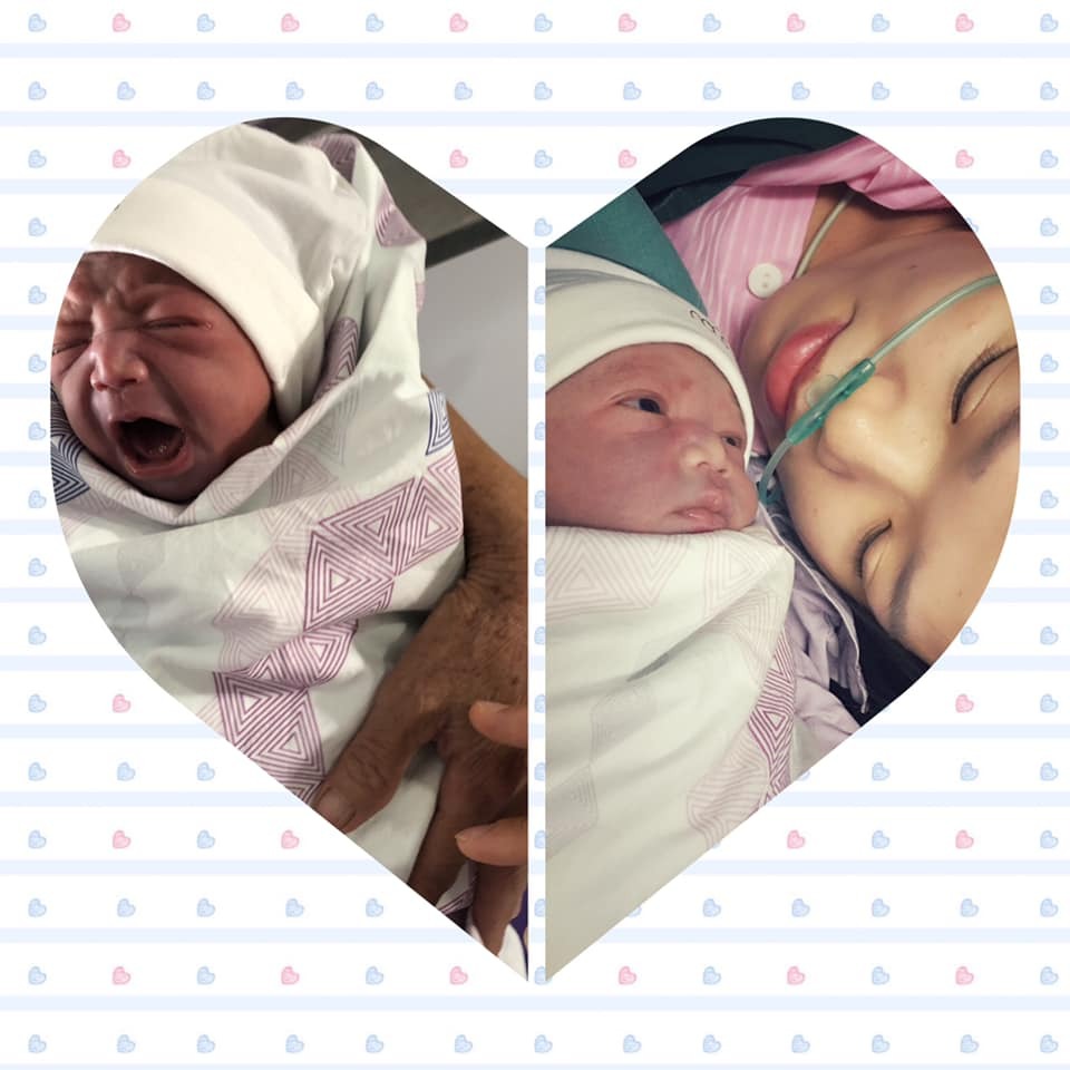 Reiew sinh mổ tập 2 ở bệnh viện hồng ngọc 🥰🐹!
Em mới sinh bé hôm 8/10. 
Bé nhà e hơi nhỏ chỉ 2,7kg nhưng tv 2mc đều khỏe mạnh . 
Hồi đi khám tại viện Hồng Ngọc có duyên gặp bác Tú luôn nên theo bác luôn cho đến khi sinh .
Mình đi đẻ không khác mẹ đơn thân đi đẻ là mấy , Chồng bị kẹt nước ngoài , bà thì cũng lớn tuổi thì phải ở nhà trông bé lớn 3t. 
Đi đẻ hồi hộp lo sợ ko biết là mình có tự chăm đc bé không , cũng nói chuyện với Bác Tú là lần 1e đẻ viện khác đến ngày thứ 3 vẫn phải ngồi xe lăn , 10 ngày về phải có người phục vụ từ a-z. 
Bác Tú động viên mãi và hứa là ngày thứ 2 e có thể tự 1m chăm bé được ( có khi chăm cả người nhà ) 🤣
. Nếu e không có người thân ở lại qua đêm thì cô y tá sẽ hỗ trợ e. 
Và đúng như lời bác nói các mẹ ạ. Mẹ e ở lại đúng đêm đầu tiên , ngày hôm sau e tự đi lại chăm bé 1m , bà chỉ đảo lên chơi với cháu là chính . 
Nếu nói là do cơ địa nên lần 1 e đau thế thì tại sao lần 2 lại êm ru , vậy thì là đi Bác Sĩ mát tay và họ có khâu chăm sóc sau sinh rất tốt . 
Mình mổ lúc 7.30p sáng không chọn giờ , nhờ bác Tú bác OK ngày đó giờ đó là mổ thôi . 
Mình đến từ 5h30p sáng làm xong hết thủ tục trước khi vào mổ hết 1 tiếng rồi chờ đến giờ vào phòng mổ . 
Đốt sống mình khá khó khăn để gây tê ( lần 1 cũng thế nhưng bị dọa hic ) khá mất thời gian ở khâu này và đau nữa. Nhưng y tá động viên rồi giữ người mình , bảo mình chị đau quá thì tay cứ ghì người e. 
Xong xuôi phần gây tê thì cơ thể bắt đầu không có cảm giác gì, thi thoảng các bạn y tá lại hỏi thăm trong quá trình mổ. Mình may mắn là nhờ được Bác sĩ Tú quay lại quá trình sinh để gửi cho ck, bác hỏi y tá ai có điện thoại nét nhất thì quay giúp mình 🤣. 
Thời gian mổ và khâu mất 1h. Mình nằm hậu phẫu đến 12h được ra gặp con 😍. 
=>Về cơm nước ngon hơn cơm nhà mình, cả ngày chỉ thấy ăn uống , 6 bữa 3 phụ 3 chính. 
=> Y tá thì nhiệt tình gọi là vào nhưng e rất ít gọi vì khỏe tự làm được ( 1 phần tính cầu toàn mình làm cho con mới yên tâm ) . 
=> khi về 1 cô y tá giúp sách đồ và dẫn xuống tận cửa taxi. 
=> chi phí thì e sinh mổ lần 2 chỉ có bhyt nên thanh toán rất nhanh 1 tiếng xong xuôi hết. 
Đợt e đăng ký 3 mẹ với nhau giảm 10%còn 29tr900k . 
- mẹ không phát sinh gì .
- con phát sinh lấy máu gót chân 900k đo thính lực 
180k. 
- mua thuốc về hết hơn 700k.
- bảo hiểm y tế e được trừ 2tr200k .
Các mẹ nào mà neo người ít người nhà thì cứ yên tâm chọn Hồng Ngọc nhé. 
Đi đẻ thực sự là nhẹ nhàng lắm nên đến ngày thứ 2 sữa mẹ đã về rồi bé được bú mẹ hoàn toàn. 
Thực biết ơn và cảm ơn bác sĩ Tú và các cô y tá. 💋💋 💋.