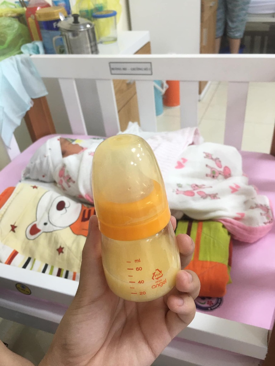 REVIEW ĐẺ MỔ TẠI PHỤ SẢN HẢI PHÒNG

Em mổ hôm 25/09, đêm 1h kém nghe cái bụp vỡ ối xối xả, bắt taxi lên viện là hơn 01h sáng, vào làm thủ tục siêu âm khám trong. 
2h kém được đẩy lên phòng mổ 

E chọn bsi Học và tính 28/09 mổ chủ động (dks 29/09) nhưng vì mổ cấp cứu lại mổ đêm nên mổ bsi Dung (thấy các chị y tá bảo trưởng khoa khoa chị mà em đang run sợ quá nên cũng ko để ý lắm 😂) 

2:50 con oe oe, y tá cho 2 mẹ con nhìn nhau thơm nhau 1 cái rùi bế bé đi. Tầm 03h hơn thì mẹ được đưa xuống phòng hậu phẫu theo dõi hơn 7 tiếng

Em mổ yêu cầu nằm sản 1 phòng 503 (4 giường 750k/ngày, BH 80%) 
Mỗi ngày được rửa vệ sinh 2 lần, tiêm thuốc 2 lần, thăm khám 1 lần, chăn ga, quần áo bv đổi hàng ngày, bv cho mượn phích nước, đc 2 cốc chè sữa hoặc nc lá 2 buổi/ngày. 

CHI PHÍ SINH TẠI PHỤ SẢN HẢI PHÒNG 💰
Vì mổ cấp cứu nên e ko chọn gói 5,5tr được
Bồi dưỡng bác sĩ mổ 1tr5
Bồi dưỡng ê kíp 1tr
Khoa sơ sinh 400 (bsi khám cho con mỗi sáng hàng ngày) 
Hậu phẫu 300
Làm hồ sơ 200
Thuốc bsi chỉ định mua để tiêm sau hậu phẫu 480 
Sữa tắm mẹ, bé, sữa uống mẹ bé 700
Về sản 1 nằm bồi dưỡng 200
Massa bé 2 lần 300
Lấy máu gót chân cho con 500
Bồi dưỡng k cần xin giấy chuyển viện vẫn được hưởng 80% 500
Cảm ơn khoa 500
Tạm ứng khoa đẻ 4tr, sản 1 3tr tổng 7tr, BH 80% được trả lại 1tr940

Ăn uống nhà em mang vì nhà gần tiện nấu nướng
Em nằm 6 ngày tổng hết 5tr060 (tiền bồi dưỡng tính riêng) 
Bsi kê đơn mua thuốc về nhà uống hôm ra viện 507k nữa 
Tổng vệ sinh đẻ lần 1 của em hết 11.647k