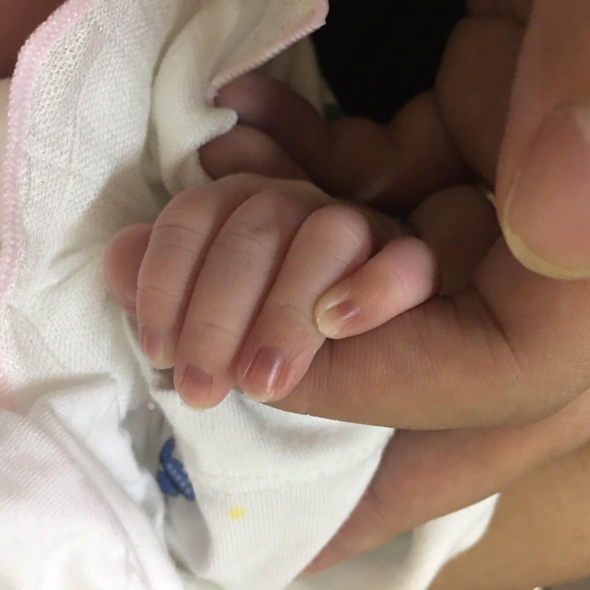 Nay rảnh em review đi đẻ thường ở Việt Nhật cho các mom tham khảo. Em mới đẻ được 3 hôm.

👶🏻 Khám thai:
Em khám tại phòng khám bs Nhân từ 6w, đăng kí hồ sơ sinh tại phòng khám từ 28w, hết 2tr1, lấy máu và nước tiểu tại phòng khám 6h sáng thứ 4, có đợt làm bác sẽ bảo. PK Bs Nhân khám chiều từ Thứ 2-Thứ 6, sáng Thứ 7-CN. Siêu âm 2D, 3D

👶🏻Dấu hiệu sinh: 
Đến 37w5d sáng sớm 3h em ra máu báo hồng, ko đau bụng, ko dịch nhầy. Sáng em vẫn đi ăn phở sợ nếu đẻ sẽ đói 😀 9h em đến bệnh viện Khoa khám bệnh, tầng 4 khám. Nói dấu hiệu thì được hướng dẫn vào khám trong, siêu âm và đo monitor. Em bé lúc ý được 2,9kg, bác sĩ bảo có cơn gò, ối ít, sẽ ra máu nữa nên yêu cầu nhập viện theo dõi. Em ko thấy đau bụng nên bảo để em gọi điện hỏi bác Nhân xem sao. Hôm đấy đúng ca trực của bác Nhân nên lên phòng bs Nhân kiểm tra lại thì bác bảo nhà gần cứ về đi. 

Trưa về em ăn uống bình thường đi ngủ trưa. 4h chiều thấy hơi đau bụng nhẹ như đau bụng kinh nhưng theo cơn 10-15’ nên tối ăn cơm xong em xách đồ vào nhập viện. 

👶🏻Vào viện-Chuẩn bị sinh: 
Khoảng 8h tối em vào viện lên thẳng phòng 300 tầng 3 được khám trong, đo monitor, thấy mở 1 phân rồi. Vẫn chưa đau bụng lắm. Sau đó cầm hss làm bệnh án, thay đồ và chờ cơn đẻ. Cứ 2h bác sĩ sẽ khám lại 1 lần. Hôm ý có bs Nhân cảm giác yên tâm hơn. 
9h tối em nằm đau hơn tí, chán lại ra hành lang đi lại ăn uống nói chuyện với chồng. 
11h30 tối em đau nhiều hơn. Bác sĩ bảo đau phải đứng ko được nằm nên em cứ ra đi bộ với chồng. 
1h30 sáng đau 5’ một cơn, đau nhiều, chồng phải dìu từng bước nhưng em vẫn cố đi chứ ko nằm hay kêu rên gì cả. Vào bảo bác sĩ, khám trong được 5’ thì em vỡ ối, sau đó được vào ngay phòng đẻ. 
Có 3 người đỡ đẻ, hướng dẫn rặn. Em đau quá nhắm mắt nhắm mũi rặn khoảng 15’ thì em bé ra đời lúc 2h20 sáng. Có rạch tầng sinh môn, khâu thì có tiêm thuốc tê. 
Nói chung đau đẻ ko quá kinh khủng như em tưởng tượng. 
Em có phong bì cảm ơn ekip đỡ đẻ.

👶🏻Sau sinh: 
6h sáng em được chuyển sang tầng 8 nhà Q. Hôm ý đông hết phòng dịch vụ nên em nằm phòng 6 giường, có nhà vệ sinh trong phòng, quạt, điều hoà, ko có tủ lạnh. 
Em bé tắm lúc 10h sáng. Được tiêm vitamin K và viêm gan B.
Đăng kí thẻ thăm người bệnh 2 người thay nhau, chỉ 1 người được ở lại. Người nhà phải ra ngoài từ 7h-10h sáng, 1h-3h chiều. Ăn uống tự túc. 
Sau sinh khoảng 6h là em tự đứng lên tập đi được.
Sản phụ được phát Betadin tự vệ sinh tầng sinh môn. Em thấy đau vết khâu còn ghê hơn đau đẻ :)) Nằm viện 24h là được ra viện. Được phát thuốc và đơn thuốc. Em có bảo hiểm tại HN, tích vào cấp cứu hưởng 80%, thanh toán viện phí hơn 500k. Siêu rẻ 😀

2 ngày sinh xong em có sữa về. Đi lại bình thường, vết khâu tầng sinh môn đang khô dần và đỡ đau nhiều. 

Em chưa có ý định sinh lần 2 nên nếu có lần sau chọn Việt Nhật không thì em ko biết 😂 

Không có dịch vụ chiếu plasma, lấy máu gót chân.

Nhưng nói chung là bệnh viện cũng sạch sẽ, trừ nhà vệ sinh tầng 3 🙂 Y bác sĩ nhẹ nhàng tận tình ko ai quát tháo mình cả. Hihi