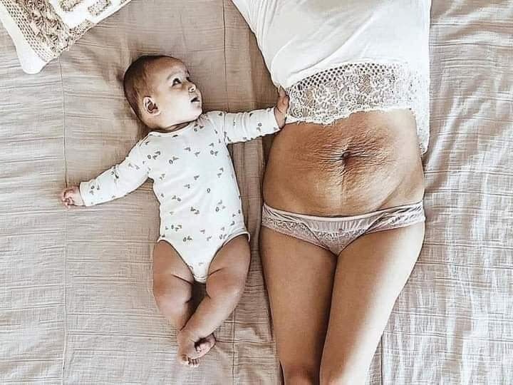 Ôi! Đàn bà 😨

😴Sinh thường: sinh thường đều rách tầng sinh môn khâu không biết bao nhiêu mũi vì hỏi bác sĩ nói khâu tới đít. Người ta nói đẻ k sợ mà chỉ sợ khâu tầng sinh môn. M thấy rất đúng . Sợ đến ghê người đau đến thâú xương .Con được bác sĩ cho ra nhờ con dao rạch tầng sinh môn của mẹ. Sau đó là những tiếng kéo chiếc kim 1 sợi chỉ. Từng mũi đi qua đau muốn thấu tim. Đẻ k khóc nhưng bác sĩ khâu thì những giọt nước mắt đã chảy dài và luôn miệng hỏi bác ơi xong chưa. 3mũi khâu trong 3mũi khâu ngoài cuối cùng 20p trôi qua cũng xong. Khâu xong những ngày đầu không thể bế con cho con ti được phải quỳ chứ ngồi cũng k ngồi được đi cũng đau chỉ nằm thì đỡ được tý. Nhìn con khóc thương hại mãi mới quỳ sao để đỡ đau r cho con ăn . Lúc ngoan thì ti mẹ hẳn hoi lúc hắn hư hắn giãy nảy mới lần đầu tiên làm mẹ cũng rối vết thương đau đến chảy nước mắt cố đứng nhanh chóng dậy đưa con để k khóc nữa nhưng mẹ thì đau đến thâú xương bởi vết khâu tầng sinh môn. Là những lúc đi nặng bị táo k thể đi được máu cứ thế chảy ra . Ám ảnh đến hết đời cũng k quên được

💘Sinh Mổ: thì rạch 9lớp mới cho được con ra. Khâu từng lớp lại những mũi tiêm tê tủy sống sẽ làm mẹ đau lưng buốt xương sống. Những vết mổ dài đi theo mẹ cả cuộc đời. Mỗi lần con sinh ra là lại xuống sức khỏe gấp bao nhiêu lần
Có 1mẹ tâm sự với m họ nói có mẹ nói "trước tao đẻ 4.5 đứa chả sao cả mà m có 1đứa mà như chết đi sống lại vậy".
đúng vậy khi bước vào phòng đẻ phòng mổ đó chính là đối diện với tử thần.
Chỉ 1lúc thôi nhưng vết thương đó mang cả cuộc đời mẹ. Đẻ 1đứa là đánh đổi thanh xuân , sức khỏe , tính mạng để có 1đua con kháu khỉnh
Vì thế hãy trân trọng những người phụ nữ họ đã hi sinh rất nhiều cho bạn để có những đứa con kháu khỉnh, khỏe mạnh luôn rộn tiếng cười nhé.