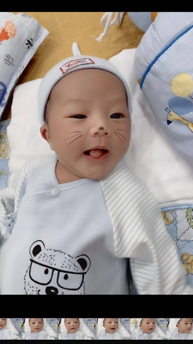 SẢN 2 THANH NHÀN - ĐI ĐẺ MÀ NHƯ ĐI NGHỈ DƯỠNG CÁC MOM Ạ 

 Mẹ con cháu xin cảm ơn tất cả các y bác sĩ khoa sản 2- BV Thanh Nhàn  đã đồng hành và giúp mẹ con cháu gặp nhau ngày 24/9 ạ❣️

Hôm nay cháu được 18 ngày tuổi trộm vía từ 3kg4==> 4kg6 . Bà Lan đỡ con mát tay lắm ạ .

Mẹ con cháu đi sinh được nằm điều hoà mát lịm, phòng ốc sịn sò mà lúc về còn có quà mang về. Các bác thì luôn nhẹ nhàng , nhiệt tình chăm sóc. 

Thật sự trước khi đi đẻ mẹ cháu sợ lắm .Sáng hôm sinh mẹ cháu vẫn đủng đỉnh đi ăn phở bò rồi mới vào viện đặt bóng ( chuột con đến ngày DKS mà chưa chịu ra nên BS tư vấn mẹ cháu đặt bóng ạ )       Đặt bóng từ 9h sáng đến 3h chiều bóng tụt .vào phòng đẻ lúc đẻ mẹ cháu còn kêu không đẻ nữa đâu đau nhảy sex trên bàn đẻ khóc ỉ ôi í ạ  . thế mà khi vượt cạn thành công thì thấy nhẹ tênh các mom ạ 😅 . Bác sĩ vẫn đang khâu TSM mà mẹ cháu đã lướt FB gọi hết người nọ người kia khoe ảnh con 😂

Chúc đội ngũ y bác sĩ khoa mình luôn dồi dào sức khoẻ, hạnh phúc và thành công ạ ❣️

Chúc tất cả các mom một thai kì khoẻ mạnh