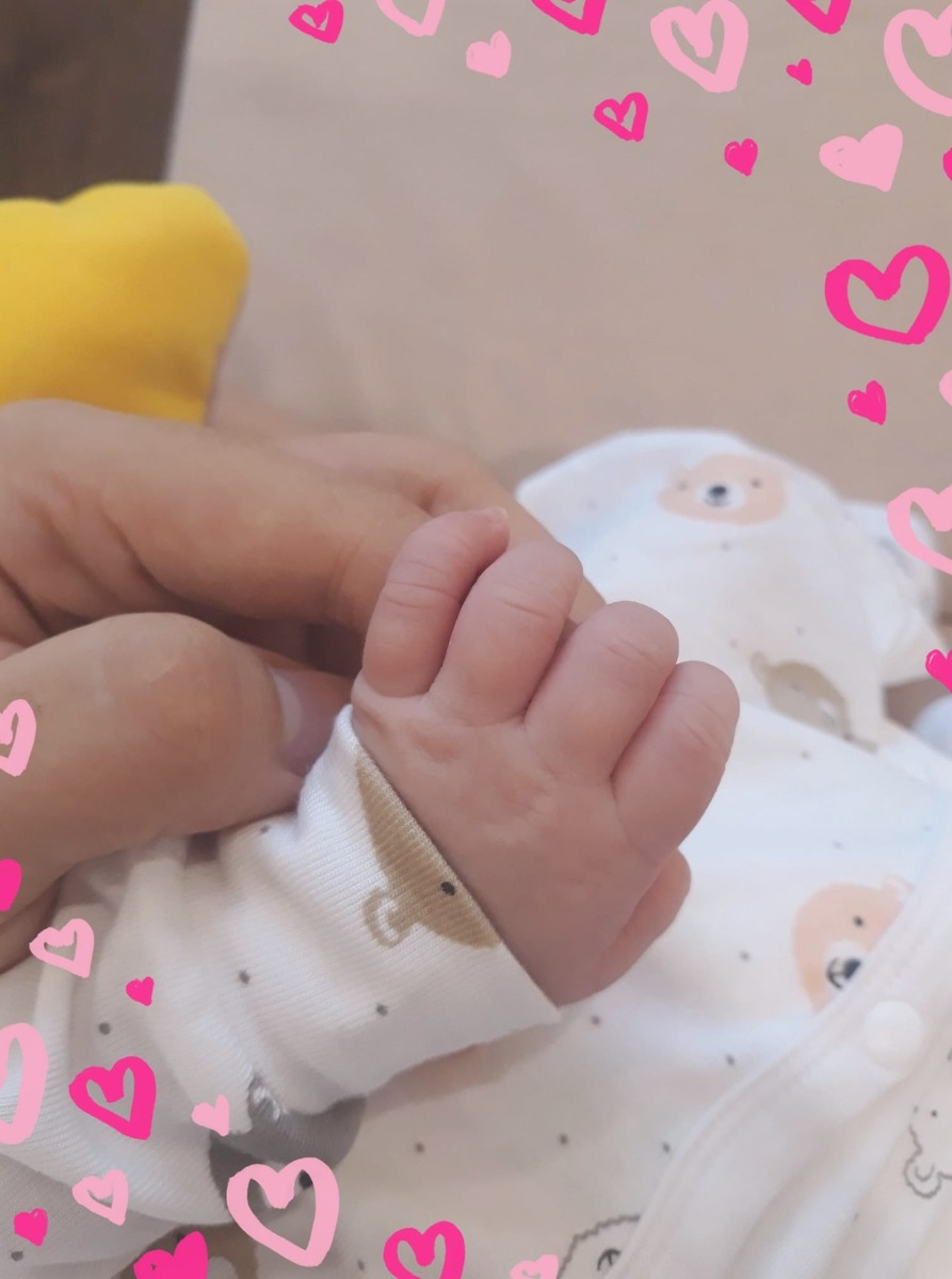 REVIEW ĐẺ Ở BỆNH VIỆN PHỤ SẢN TRUNG ƯƠNG VÀ CHI PHÍ CHO CÁC MẸ

Mình dự sinh 25/9 thì trưa 22 ra dịch nhầy đặc như lòng trắng trứng, bụng âm ỉ đau, thế là vội vàng tắm rửa gội đầu cùng người nhà xách làn lên viện. Tới nơi mình đến thẳng nhà BC khám cấp cứu, được đưa vào khám trong và đo monitor, bs kết luận chưa mở phân nào, về nhà theo dõi thêm và hẹn 2 ngày khám lại.

Sau đấy thì dịch mình ra chuyển màu nâu hồng, bụng vẫn âm ỉ đau nhưng lúc ngủ trưa và đêm con gò nhiều kinh khủng. Chiều 24 mình đi khám lại theo hẹn tại nhà BC lúc 6h, các chị ở đấy kêu là em chưa có dấu hiệu gì khác lần trước thì phải khám vào ban ngày ở nhà G chứ, mình vào khám bs cũng lắc đầu bảo chưa mở, quả đấy nghĩ là lại phải về nữa rồi thì sau khi đo monitor 45p + theo dõi 15p bs gọi vào khám trong lần nữa kết luận đã mở 2p phải nhập viện ngay. Mình được đưa quần áo ở bv để thay và nằm lên giường thụt rửa cho đi ngoài ra hết, lúc này bụng mới bắt đầu quặn đau như đến tháng.

Mình được chuyển thẳng lên tầng 7, ng nhà ở dưới có thể lên đưa đồ nhưng đứng ngoài tuồn vào thôi. Lên t7 lại tiếp tục đo monitor 30p, xong thì bs cho ra giường nằm rồi ko thấy ai hỏi han gì nữa. Tới lúc đau quá mình lết ra ngoài bắt đại một chị hỏi em đau quá muốn tiêm giảm đau, chị ấy mới khám trong cho và bảo của mình mở 2p thôi bao giờ 3p mới tiêm được. Lúc này thì người nhà mình mang đồ ăn đến là 2 quả trứng luộc và gà tần, do đau nên mình chỉ chén tạm trứng cho đỡ đói và ác mộng bắt đầu từ đây. Ăn xong nằm đau một lúc nữa thì có bs đi qua thấy mình quằn quại trên giường nên gọi vào khám, vẫn là 2p phải tiếp tục nằm chờ mở thêm. Lúc này tự dưng mình thấy nôn nao chóng mặt nên gọi người nhưng vừa mở miệng ra thì nôn thốc nôn tháo, mồm còn đang đeo khẩu trang nên bị phun ngược hết lên mặt và tóc. Bs mới kêu trời lên bảo em ăn trứng hay sữa gì đúng ko? Thế thì nôn là phải rồi! Sai lầm của mình là trước khi đi khám ko ăn gì và để bụng đói chịu đau quá lâu, sau đó lại ăn mỗi trứng uống nước nên nôn xong muốn ngất luôn. Bs bảo nôn thế này ko tiêm giảm đau được đâu, thế là ng nhà mình phải lên tiếp tế cho bát cháo rồi mới tiêm được. Ngta sẽ gọi ng nhà mình lên đóng tiền giảm đau 1.5tr nhé, mình khuyên các mom nên dùng đi vì nó đỡ đau hơn hẳn đấy.

Lúc này đã là 4h sáng và nhờ mũi tiêm đó mình mới nằm chợp mắt lấy sức được tý. Mình nằm ở phòng đẻ 8 giường có bs khám trong liên tục, đến 7h sáng mới chỉ mở được 5p nên bs quyết định tiêm mũi kích đẻ. Tiêm xong thì cơn đau đến dồn dập hơn, đau kinh khủng, đau đến nỗi tiêm giảm đau cũng ko tác dụng gì luôn. Mình phải chịu thêm mấy mũi kích đẻ nữa đến 11h mở được 9p nhưng bs khám trong hô rặn thử xong vẫn lắc đầu bảo chưa đẻ được. Mình đau quá xin được mổ thì bị bs mắng té tát, bảo từ giờ đến 12h30 mà vẫn ko đẻ thường được thì cho mổ. Phòng đẻ từ lúc mình vào nằm phải đến chục người cứ vào đẻ xong rồi được ôm con ra, ko ai phải chờ vật vã như mình, 12h y tá bs đi ăn trưa hết có mỗi mình nằm chịu đau trong phòng, khổ sở đếm từng phút luôn ấy. Cuối cùng đến 12h15 bs ra thọc tay khám trong, hô rặn một lúc rồi lắc đầu bảo thôi mổ 😭 nguyên nhân chỉ định mổ là đầu con ko lọt.

Thủ tục chuyển mổ làm khá nhanh chóng, ng nhà mình sẽ được gọi lên t7 đóng tiền. Mình được chuyển sang nhà khác mổ, cứ nghĩ thôi ko được da tiếp da thì ít nhất cũng được nhìn mặt con lúc mới ra đời, nhưng mình gây tê bị co giật toàn thân nên bs gây mê luôn. Lúc tỉnh dậy đã nằm trong phòng hồi sức rồi, con thì đang ở tầng sơ sinh 24 tiếng sau mới về với mẹ, ngta chỉ cho bố lên nhìn mặt một chút thôi. Sau khi mình mổ xong họ sẽ gọi ng nhà lên hỏi có làm gói giảm đau sau mổ ko, đồng ý thì đóng 3tr, bs sẽ cắm ống tiêm thuốc sau lưng mình và giữ vậy trong 3 ngày ở viện. Nhờ thuốc này mà sau mổ mình ko bị đau lắm.

Mổ xong có y tá đến hỏi mình có muốn nằm phòng dv ko? Có nhiều loại nhưng lúc ấy còn đúng 1 giường 1tr2 thôi nên mình đk luôn. Phòng 1tr2 có 3 giường và 1 wc bên trong, tủ lạnh cây nước nóng và giường cho ng nhà đầy đủ, sạch sẽ có ng lau dọn thường xuyên. Hàng ngày có ng đến tiêm thuốc thay băng, làm vệ sinh cho mẹ và tắm cho bé, nói chung dịch vụ rất ổn.

Chuẩn bị đồ đi sinh ở phụ sản trung ương:
Ban đầu mình chuẩn bị cho sinh thường nên thiếu nhiều phải về lấy liên tục, mình thấy những đồ cần mang gồm có:

- Cho bé:
+ Khăn sữa
+ Bỉm, kem hăm
+ Nước muối sinh lý, tăm bông nhỏ
+ Khăn khô đa năng
+ Bao tay bao chân
+ Quần áo cho bé 1 bộ lúc ra viện

- Cho mẹ:
+ Bỉm carry (viện tặng 3 miếng ko đủ dùng)
+ Quần lót giấy
+ BVS mama
+ Tất, quần áo ra viện
+ Cốc nước
+ Chậu con
+ Máy hút sữa, bình sữa

Bảng giá bệnh viện phụ sản trung ương: Tổng tiền mình chi hết hơn 16tr, trong đó bảo hiểm 80% được giảm 4tr, đa số đắt ở các dịch vụ bảo hiểm ko chi trả như:
- Giảm đau đẻ thường: 1.5tr
- Giảm đau sau mổ: 3tr
- Tiền phòng 5 ngày: 6tr
- Cảm ơn ekip mổ: 2tr
- Thuốc cho mẹ+con: tầm 2tr
- Chiếu tia plasma 2 ngày: 800k

Lần này mình đi đẻ ăn trọn combo đau đẻ thường + đẻ mổ đúng là nhớ đời luôn, chắc tại lười đi bộ nên bụng trên cao quá ko tụt xuống thành ra khó đẻ 😂 theo đánh giá của mình thì dịch vụ ở Pstw rất tốt, đẻ ở đây cũng yên tâm nữa mỗi tội xin mổ các bs khó ghê