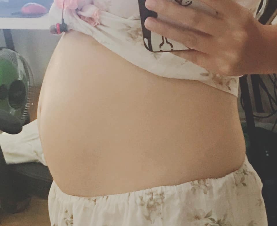 😍Khoe bụng 32w ạ. Chuột nhà các mom biết làm những gì rồi ạ? Biết động đậy máy máy phản ứng lại mỗi lần mẹ thai giáo chưa ạ?🥰

Còn 2 tháng nữa là tới bến rồi các mom ạ, em bận lắm mà tối nào cũng gắng dành cho con 20, 30 phút để thai giáo. Cũng may có app mamibabi này mà việc thai giáo nhàn hơn rất nhiều. Hồi đầu chưa bít, cứ lên mạng tìm tìm đủ các phương pháp, xong về sau loạn chưởng "chuyên gia", chẳng bít đâu mà lần, thấy nhiều chuyên gia quá 😂😂😂

E cũng mua hết mấy khóa học về rồi, toàn nói nói thôi, mất thời gian lắm, xem xong chả biết làm gì. Mà cũng chả đủ thời gian xem hết, thời gian cho con còn ko có. Tiện nhất là dùng app này, cứ mở ra và làm theo thôi, đơn giản dễ hiểu 😊

Mẹ con em thai giáo cho nhau từ hồi đầu mới bầu, lúc chưa đạp đc thì cu cậu máy máy, giờ quậy tưng tưng mỗi lần cho nghe nhạc, nghe chuyện rồi, bố gọi cũng thấy động đậy ngay, hay ghê 🤣🤣

Nhiều mom hay tâm sự là dạo này chẳng thấy con đạp, con máy thì lo lắng. Cũng giống bé nhà em thôi ạ. Nếu máy ít quá thì cần đi khám, còn bt thì các mom cứ chịu khó thai giáo đều cho bé là đc. Đổi truyện, đổi nhạc cho các bé nghe chứ nghe mãi 1 bài mình cũng chán huống hồ các bé 🤣🤣

E tâm sự thế thôi ạ, bụng này các mom đoán là Chuột zai hay Chuột gái?😁😁