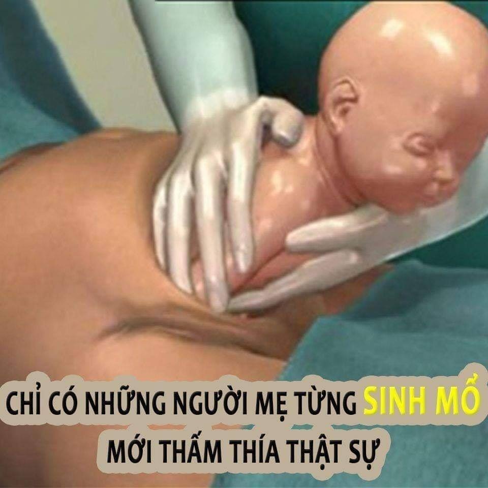 Chồng nói: “Mổ nhanh thôi vợ cố gắng chịu đau một tí, vài năm nữa hết sợ lại đẻ đứa nữa nhá!”

Nhưng có ai hiểu được sự sợ hãi trong phòng mổ của EM không?

AI SINH MỔ SẼ HIỂU

Nhìn tấm ảnh này cảm giác ngày hôm đó lại về. Là cái cảm giác vừa lo sợ, vừa trông được gặp con. Là cảm giác cô đơn nằm trong phòng mổ Cảm giác cứ sờ vào vết mổ như kiểu muốn tách ra nữa vậy.

Rất sợ mùi bệnh viện, sợ phải thấy bệnh viện, vẫn còn ám ảnh luôn... 😞
Vào phòng mổ:

- Cởi bỏ quần áo, nằm dạng hai chân hai tay lên bàn.

- Bác sĩ làm các thủ tục thăm khám: Huyết áp, vệ sinh vùng bụng các kiểu.

- Còng hết lưng ôm trọn bụng để tiêm gây tê, bác sĩ chọc đi chọc lại tủy sống mấy lần mới được.

- Cảm thấy mất cảm giác từ lưng xuống chân. Đầu vẫn hoàn toàn tỉnh táo

- Và bắt đầu nghe tiếng dao kéo rạch, mổ, xẻ, cảm nhận được từng lưỡi dao kéo lia trên thớ da thịt.

- Bác sĩ đón con ra, nhẹ bẫng người!

- Phòng hồi sức lạnh ngắt như nhà ma. Rét run như lên cơn sốt. 😥

Và dã man nhất là cái cơn đau sau mổ, khi hết gây tê, như muốn chết luôn được - đau như đúng kiểu chết đi sống lại. 😭

Vết mổ đau cho tới mãi sau này: lưng đau nhức, mũi gây tê ảnh hưởng thần kinh nên quên trước quên sau. 😪 Ai hiểu , ai thông cảm cho thì mừng không thì ăn chửi suốt ngày vì chứng đãng trí sau sinh.

Chỉ có những người mẹ từng sinh mổ mới thấm thía thật sự.