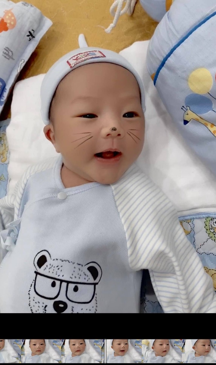 SẢN 2 THANH NHÀN - ĐI ĐẺ MÀ NHƯ ĐI NGHỈ DƯỠNG CÁC MOM Ạ 

 Mẹ con cháu xin cảm ơn tất cả các y bác sĩ khoa sản 2- BV Thanh Nhàn  đã đồng hành và giúp mẹ con cháu gặp nhau ngày 24/9 ạ❣️

Hôm nay cháu được 18 ngày tuổi trộm vía từ 3kg4==> 4kg6 . Bà Lan đỡ con mát tay lắm ạ .

Mẹ con cháu đi sinh được nằm điều hoà mát lịm, phòng ốc sịn sò mà lúc về còn có quà mang về. Các bác thì luôn nhẹ nhàng , nhiệt tình chăm sóc. 

Thật sự trước khi đi đẻ mẹ cháu sợ lắm .Sáng hôm sinh mẹ cháu vẫn đủng đỉnh đi ăn phở bò rồi mới vào viện đặt bóng ( chuột con đến ngày DKS mà chưa chịu ra nên BS tư vấn mẹ cháu đặt bóng ạ )       Đặt bóng từ 9h sáng đến 3h chiều bóng tụt .vào phòng đẻ lúc đẻ mẹ cháu còn kêu không đẻ nữa đâu đau nhảy sex trên bàn đẻ khóc ỉ ôi í ạ  . thế mà khi vượt cạn thành công thì thấy nhẹ tênh các mom ạ 😅 . Bác sĩ vẫn đang khâu TSM mà mẹ cháu đã lướt FB gọi hết người nọ người kia khoe ảnh con 😂

Chúc đội ngũ y bác sĩ khoa mình luôn dồi dào sức khoẻ, hạnh phúc và thành công ạ ❣️

Chúc tất cả các mom một thai kì khoẻ mạnh