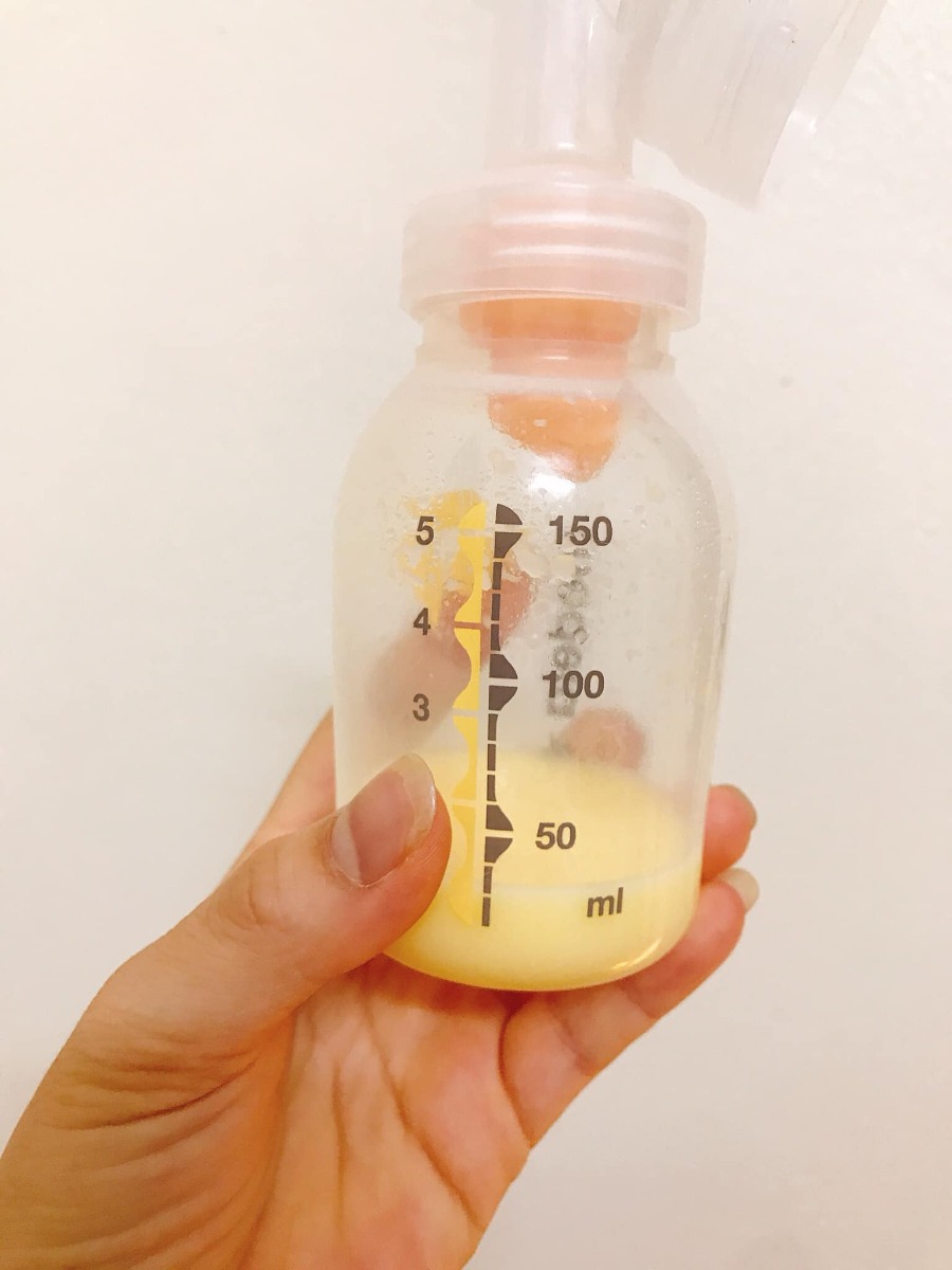 Mình cán đích thành công sinh thường tập 3 bé trai 38w5d 3,3kg rồi nè. Nay mình chia sẻ với các mom một chút. Về thai kỳ, ăn gì, sinh con ở đâu, sau sinh của mình. Mình sinh bé đc 4 ngày rồi ạ.

1. Về thai kỳ:

Mình phát hiện tđtk tuần 28 khi đi làm xn tại bv Bạch Mai. Mình sinh tập 2 ở đây nên tập 3 cũng sinh đây luôn. 2 bé trước khoẻ mạnh và mình ko bị tđtk. Tập 3 tự tin lắm là ko bị vậy mà nhận kq ngỡ ngàng. Mình bị cao sau ăn 2h (8,7 > 6,7). Trước khi phát hiện mình đi siêu âm con đều to hơn chuẩn. Phát hiện ra bệnh là những ngày ăn kiêng bắt đầu... mẹ sụt kg, con bé, stress, rối loạn đường sau ăn, rối loạn đường đói... mình đủ cả. Có khi đường vọt lên 10,4. Có 1 lần 10,8. Cả 2 lần đều do đồ ngọt. 1 lần bánh ngọt và 1 lần trà sữa 0 đường vẫn vọt như bt dù mình uống ít. 
Mình đã áp dụng cách ăn như bên dưới để đường về ngưỡng và con tăng cân đúng chuẩn trở lại. Ăn gì mình cũng test để tìm ra thực đơn hợp với mình. Từ tuần 36 trở đi mình ăn cơm trắng 1/3 chén ko bị tăng nữa nên thỉnh thoảng vẫn ăn cơm. Mình ko tập td đc nhiều vì bầu bụng thấp đi lại khó chịu lắm. Chăm 2 bạn nhỏ 7y và 2y nữa. Công việc cũng khá bận. Ăn uống mình ko quá cầu kỳ, tìm những thực phẩm theo mùa, giá cả phải chăng, dễ mua ở chợ. Mình uống thêm sữa glucerna vào buổi tối từ tuần 33. Mình làm dung nạp tuần 28, điều chỉnh chế độ ăn và cứ cách 4 tuần tái khám làm hba1c đều trong ngưỡng.

Bé này mình sinh sớm hơn so với 2 bé trước. Cũng may cân nặng ổn và trộm vía bé rất nhanh nhẹn, cứng cáp. Lần t3 rồi nên cũng dễ đẻ lắm. Đau có hơn tiếng là đẻ rồi. 😁

2. Nơi mình sinh con:

Mình đã trải nghiệm cảm giác kinh hoàng khi sinh bé đầu năm 2013 ở sản C nên hãi luôn ko bh dám quay lại. Tập 2 mình chọn sinh ở Bạch Mai. Khoa Sản toà nhà Việt Nhật. Mình đc giới thiệu cho chị y tá đỡ đẻ luôn của khoa, đc cái 2 c e rất hợp tính nhau, chị nhiệt tình vô cùng nên cảm giác rất thoải mái, tự tin đi đẻ. Lần 2 và 3 mình đều nhờ chị. Việc đi khám và tái khám có chị giúp nên nhanh chóng, dễ dàng. Đến lúc sinh chị đỡ luôn cho nên yên tâm lắm. Sinh xong bé đc da tiếp da lúc lâu, trì hoãn kẹp rốn để lấy đc hết máu dây nhau. Bé cũng đc test tiểu đường, tiêm vtm K và viêm gan B tại viện. Hai mẹ con về phòng 6 giường nằm 1 ngày hôm sau ra viện. Phòng sạch sẽ, rộng rãi, vệ sinh khép kín, có nước nóng của bv 24/24 để pha sữa cho bé. Mình có bảo hiểm nên chỉ phải trả khoảng 570k cho tất cả. Mình cảm ơn kíp trực 2tr, cảm ơn chị y tá giúp mình 2tr. Đợi đến 8w đi test lại đường sau sinh và kiểm tra vết khâu tầng sinh môn luôn là ổn.

3. Sau sinh:

Mình sinh đc 4 ngày rồi. Vẫn áp dụng chế độ ăn nhiều rau, đạm và ít tinh bột như thai kỳ. Sau sinh 18 tiếng mình có sữa non. Ảnh là sữa 1 cữ hút ở 72h sau sinh của mình. Ăn uống thì mình mới ăn ruốc, thịt rang, bò, tôm, rau ngót, đu đủ, thanh long đỏ thôi. Mỗi bữa tô cháo yến mạch thay cơm. Mình thích cháo yến mạch dễ ăn lắm 🙂 

Trên đây là những chia sẻ của mình. Mình cũng mong là thoát đc tiểu đường sau sinh. 

Mấy hôm nữa mình sẽ uống thêm tảo và bột nghệ mật ong này.

Chúc các m giữ đc tinh thần thoải mái, vượt cạn thành công nhé 🙂 

À m nào mà cứ hỏi ăn này ăn kia đc ko nhưng sợ ko dám test với ko mua máy test mình ko đồng ý chút nào. Cơ thể mình, con mình mà lơ là quá. 

Mỗi người 1 cơ địa có ng hợp ng ko nên cần phải test để tìm ra cái hợp với mình chứ. Cố gắng lên nào !