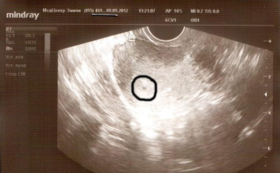 Thai 4 tuần như thế nào? Quan hệ có sao không?