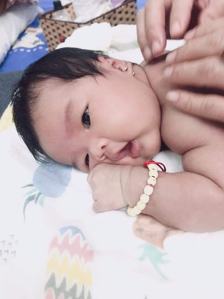 Review đi sinh tại Sản 2 bv Thanh Nhàn cho những mom nào còn phân vân (hơi lười đọc vì khá dài ạ)
Tới nay đã sinh được hơn 1 tháng (24/10) thì em mới ngoi lên để CẢM ƠN các tập thể khoa sản 2 và 1 vài cảm nhận của em khi sinh con đầu tại đây
- Về khoa: ban đầu em băn khoăn giữa 108 và sản 2 vì đều gần nhà em. Và sau khi tìm hiểu em quyết định chọn sản 2, ko hề hối tiếc.em theo dõi tại khoa từ tuần thứ 12, đi khám đúng theo lịch hẹn. Tóm tắt 1 số điều như sau:
+ Nên theo dõi tại khoa từ đầu nếu có ý định sinh ở đây, vì có hồ sơ đầy đủ các mốc, các bác sĩ cũng tiện theo sát thai kỳ, thuận lợi hơn cho khi sinh. 
+ Thủ tục ở khoa nhanh, gọn. Đi thẳng lên tầng 5 mà không cần qua cửa nào khác. Chưa đóng tiền vẫn có thể sắp xếp khám trc, đóng tiền và nhận kết quả sau. Đi 1 mình có thể nhờ các bạn thực tập đóng giúp ( nhờ cô Sơn ở phòng 511 nha). Đây là điểm đặc biệt so với các bệnh viện khác cứ phải đóng tiền đầy đủ theo chỉ định mới đc khám.
+ ko sợ quên lịch khám vì trc ngày khám cô Sơn đều nhắn tin. Xét nghiệm ko cần chờ kết quả vì cô sẽ gọi điện hoặc nhắn tin báo
+ đi siêu âm 4d ơi khoa khác thì có ng đưa đi hoặc ở sẵn đó đón.
+Ở đây có phương pháp Đặt bóng kích chuyển dạ, cho những mom muốn đẻ thường mà khó chuyển dạ tự nhiên (e có dùng pp này và sinh đúng ngày dự sinh)
+ Nên đăng ký full các dịch vụ như: chiếu đèn plasma cho mẹ, đo vàng da, thính lực cho con... ( chi phí ko quá nhiều mà mình yên tâm)
+ Phòng 2 giường khó đăng ký vì ít, nhưng các mom cứ mạnh dạn ở phòng 8 giường vì mình thấy khá ok, sạch sẽ, không ồn ào quá đâu ạ
+ mom nào muốn gội đầu, giặt là, massage... ở đây đều có
+ đẻ xong con đc da kề da với mẹ, đc cắt rốn chậm và cắt laser. ( về nhà rốn con em khô cong, dễ vệ sinh)
+ Tất cả các bác sĩ , điều đường, hành chính , các em thực tập... đều rất nhiệt tình, vui vẻ, tận tâm ( đây là điều em chưa gặp đc ở các bv công khác)
- Riêng về bác sĩ Quyết: Không biết khen ntn cho hết: bác sĩ giỏi, tâm lý, nhiệt tình, nhẹ nhàng,mát tay, tận tâm, chu đáo( giúp việc đi đẻ lần đầu của em ko hề đáng sợ như lời đồn. 🤣).
+ ban đầu em định ko nhờ bs nào cả, vì thai kỳ của em đều thuận lợi, các bs em đều yên tâm. Nhưng sau gia đình em mong muốn cẩn thận hơn nên em mạnh dạn liên hệ nhờ bs Quyết. Ban đầu cứ lo không đc, vì em muốn đẻ thường, khó quyết định đc thời gian. Nhưng ko ngờ bs rất dễ tính ạ! 
+ em dự sinh 24/10 mà đến trc đó 2 ngày mới chỉ có máu báo, chờ đến 23/10 vẫn chưa 1 cơn đau. Sáng 24 vẫn phăm phăm xách đồ vào viện, đặt bóng từ 9h. Em cùng 1 chị đặt bóng nữa thi nhau đi bộ, em chỉ thấy hơi mỏi và lâm râm đau chứ vẫn chưa biết đau đẻ là ntn. Đến 14h bs gọi vào, tụt bóng và bắt đầu truyền. Vừa nằm truyền vừa xem chị bên cạnh đẻ. 🙄. Vẫn chỉ là những cơn đau rời rạc. Đến 16h bắt đầu đau dữ dội hơn, bs cho em đứng lên ngồi xuống ( nhớ ko nhầm là để mở nhanh hơn). 17h15 không chịu đc nữa và lên bàn rặn. Và tèn tén ten 17h33 con em đã oe oe( em bé 3,3kg theo đúng siêu âm trc đó). 
+ em được khâu thẩm Mỹ tsm , nhưng cảm giác bình thường,chỉ thấy nhói nhói tí thôi ạ. Hôm sau em đi vệ sinh bình thường, không đau sót mặc dù đã chuẩn bị trc tinh thần sẽ rất đau. Mấy bạn chiếu plasma cho em đều khen vết khâu đẹp thế,nhìn mãi mới thấy. Sau khi ra viện về vết khâu lành nhan, em đi đứng, ngồi, nằm đều bình  thường. Đẻ rồi hỏi em có sợ đẻ tiếp không thì em không ạ!🤪
+ nói chung bác sĩ cực kỳ mát tay, khám trong cũng nhẹ nhàng( e ko thấy đau như nhiều mom sợ), em bé trộm vía bác đón tay ngoan, háu ăn,nhanh lớn, nhưng hơi đanh đá ( cái này nói xấu bs vì em biết từ trc rồi) 😝
- LỜI CẢM ƠN: em xin chân thành cảm ơn tất cả tập thể sản 2 TN.Chúc sản 2 ngày càng lớn mạnh! 
- ĐẶC BIỆT CẢM ƠN bác sĩ Kiều Quyết, giúp em loại bỏ cảm giác sợ đẻ, chắc chắn nếu em sinh 4 cô con gái ( còn 3 cô nữa) 😅 em vẫn sẽ theo chân anh và mong anh vẫn sẽ đồng ý. Chúc anh mạnh khỏe, hạnh phúc và thành công!
Đẻ xong rồi mà cảm giác vẫn lưu luyến quá nên em viết hơi dài. Giờ gặp ai quen chưa chọn đc nơi sinh em đề giới thiệu tới đây. Cả nhà em đều khen dịch vụ và cách chăm sóc ở đây tuyệt vời. Còn nhiều điều nữa nhưng dài quá rồi, mom nào muốn biết thêm thông tin cmt , e biết em sẽ trả lời ạ! 😍