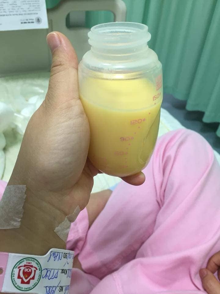 Mom nào xin vía nhiều sữa hok ạ
Rút kinh nghiệm từ tập đầu ko có sữa cho con. 
Đúng là làm mẹ chỉ mong ntn thôi các mom ạk. Có sữa cho con là thấy hp lắm. 
Căng sữa là e lại vắt ra dc cừng này, bé nhà e mỗi cữ chỉ ty 70-80ml thôi nên vẫn dư sữa. Theo các mom e có nên vắt ra nữa ko hay để cho bé ty thôi(e ko có nhu cầu trữ sữa đông ak ).mk ko vắt thì ngực e căng đau lắm cứ để vậy thì có bị tắc tia ko ạ. Mom nào có kn cho e xin í kiến ak. 
Tiện thể các mẹ ủn mông cho con hay ăn chóng lớn nhé😊😊
