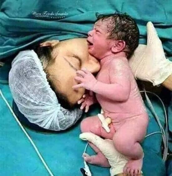 Bác sĩ này đã công bố bức ảnh này, ông đã khóc và viết:

Hôm nay là ngày buồn nhất trong cuộc đời tôi. Là một bác sĩ, tôi đã cứu chữa cho nhiều phụ nữ mang thai. và bất cứ khi nào tôi ở bệnh viện, tôi đều cầu nguyện với Chúa để bảo vệ và ban phước cho tất cả các bà mẹ. Nỗi đau của người phụ nữ khi chuyển dạ là không thể chịu đựng được và không chỉ liên quan đến việc mang đứa trẻ trong chín tháng, mà còn là sự hi sinh để đứa trẻ có cuộc sống mới.

Hôm nay chúng tôi đã khóc một cách cay đắng, chúng tôi đã mất một người phụ nữ:

Cô ấy có túi trên buồng trứng và một khối u lớn. Khi cô mang thai, khối u này bắt đầu tan chảy và mọi thứ đều ổn. Trong thời gian sinh nở, chồng cô vội vã đến với tôi và để lại tất cả công việc cho tôi và lao động trong bảy giờ cho đến khi chúng tôi quyết định mổ cứu lấy đứa bé, cô ấy bế con trên tay và mỉm cười rồi ra đi .. Người mẹ ấy đã qua đời. và đứa trẻ sống, chồng cô ngất đi trước tin cô qua đời.

Vì vậy, Hãy tôn trọng phụ nữ vì họ sẵn sàng hi sinh tính mạng để mang đến cho con họ một cuộc sống mới. Trong chín tháng mang thai nặng nề, khó chịu, họ còn phải chịu đựng những đau đớn khủng khiếp khi sinh con, nhiều đêm dài thức trắng để chăm con, nuôi dạy con cái, đó là sự hy sinh lớn lao của người mẹ.

Nếu bạn đã lâu không nói chuyện với mẹ hoặc thăm mẹ vì bất kỳ lý do gì, xin vui lòng đến thăm họ ngay bây giờ nhé. Hãy thể hiện tình yêu của bạn dành cho mẹ và tôn trọng sự hi sinh của mẹ để bạn có được cuộc sống như ngày hôm nay nhé!