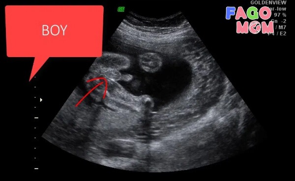 Hình ảnh thai nhi 13 tuần tuổi