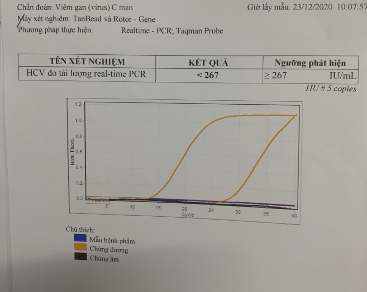 D không phải là người theo đạo, nhưng Noel năm nay bản thân D cảm thấy được ban phước lành. 

Bản thân là một đứa chết nhát, 20 tuổi đã bắt đầu khám sk định kỳ và 21 tuổi đã đi mua bhnt. Nhờ v mà có gì chệch phát là D biết liền, nên D tự tin về sk mình lắm. 
Rồi bé Mỡ đến bất ngờ như du kích, nên bh có thêm cái màn khám thai định kỳ nữa quý vị à. 
Khổ, tuần rồi trong lúc đợi kq double test, D panic attack lần 2 vì sợ ẻm bị Down, bị Edward này nọ, trong đầu vẽ 7749 viễn cảnh bi quan vì bs nói “sao nhìn ốm ốm mà mỡ bụng dày vậy, siêu âm chả thấy gì” ☹️ D sợ bs phán bừa, ghi đại độ mờ da gáy nên hồi hộp đợi kq xét nghiệm lắm. 
Tới ngày lấy kq thì bs chỉ lật lật xem trong 30 giây “Diên ơi em bé bt nhé”. Bản thân mình đang lâng lâng thì bs kéo tụt xuống đất lại. “Cơ mà em qua CK Gan kiểm tra kỹ lại nhé, hình như e bị viêm gan C”. 
Và thế là chuỗi ngày bi quan vô cùng cực của D lại bắt đầu. 
Bữa đó về nhà là D ggl hết tất cả các trang về viêm gan C. Nào là viêm gan C dẫn đến xơ gan, phải ghép gan, rồi sau này sẽ dẫn đến ung thư gan. Con sinh ra có nguy cơ nhiễm viêm gan từ mẹ, k thể sinh thường để hạn chế tiếp xúc với máu mẹ, k thể bú mẹ bla bla bla 😖 rồi chi phí điều trị tầm 100-200tr nữa chứ. Nói tóm lại là panic attack lần 3 trong 2 tuần. Khóc muốn lòi con mắt, ngồi ăn cơm mà nước mắt cứ chảy ra như phim dài tập sóng gió gia tộc v. Mấy ngày liền D k mở miệng nói tiếng nào luôn á. Nghĩ tới cảnh k thể chữa ngay vì thuốc sẽ gây dị tật thai nhi, sinh em bé xong rồi chữa bệnh sẽ bị mất sữa tác dụng phụ các kiểu. Ôi thôi nó bi kịch quý vị ơi. 
Rồi hôm qua 24/12 D lại lên bv nhận kq xét nghiệm chuyên sâu về viêm gan C, xn này nhằm xem con virus nó có đang hoạt động trong người mình không. Vì xn ban đầu anti HCV chỉ cho thấy trong máu m đã có kháng thể viêm gan C thôi, mà viêm gan C thì chưa có vắc xin nên chỉ có thể là m đã hoặc đang bị bệnh này. Kq là D k có bị viêm gan C quý vị ơi!!!  D nằm trong số 25% đã bị và cơ thể đã tự tạo miễn dịch thành công đó! Trong bv mà D hét lên làm bs hú hồn hú vía luôn, thiếu điều ôm luôn chú bs 😌. Sau đó còn ngồi tâm sự nhẹ vs chú bs về mấy ngày lên voi xuống chó vừa qua nữa chứ. Chú bs cười cười “lại bác sĩ google à😏, thôi giờ về đi, rảnh thì dắt ông xã lên đây anh kiểm tra lại một thể, lưu số dt a rồi lên thẳng đây luôn nhé” 
Tâm sự mỏng đến đây thôi. D hông có bán bh hay kem trộn gì đâu nên quý vị đọc đến đây đừng nghĩ D quảng cáo nhé 😌 D chỉ muốn nhắn nhủ mọi ng là hãy đi khám sk định kỳ thường xuyên, vừa bảo vệ mình vừa bảo vệ những người yêu thương của mình. Vậy thôi. 

Peace out! ✌️