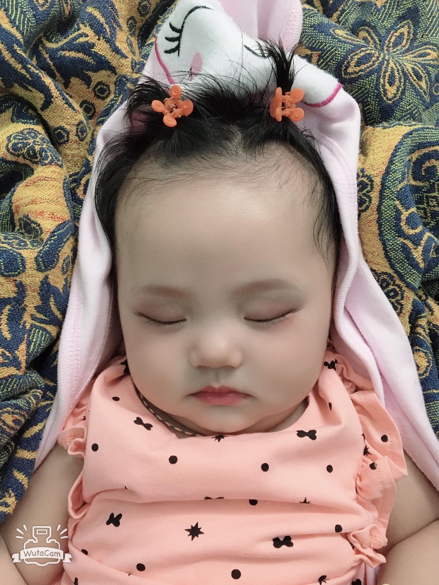 Review đi đẻ bệnh viện Hùng Vương 😀

Hút sữa xong cử 00:00 là e tỉnh ngủ, ngủ lại k được nên là buồn buồn viết bài review đi đẻ😌

13/09/2020 - Ngày mình gặp nhau đó Lavie à☺️

*** Thăm khám thai:
Từ đầu thai kỳ cho đến lúc vỡ chum e theo dõi bác sĩ tư, bác Hải Châu bv Hùng Vương . Bác hiền nhiệt tình, khám kỹ có điều lúc nào cũng đông nên là đi khám phải đi sớm nè.

*** Hành trình đi đẻ: 
Ngày 10/9/2020 e te te đi khám thai như bth, vô khám bs bảo nở 1phan về nhà theo dõi nếu tối có đau bụng thì vô bv ngay k thì mai quay lại khám tiếp, r mai quay lại khám thật tối đó khám xong bác kêu nhở 2phân r về nhập viện nha e, hỏng ai như e luôn sợ đẻ lắm hỏi bác mai sáng dc k, bác nói v thoi mai sáng cũng dc mà khuya có gì là nhập viện liền nha.

Xong về quyết định đi ăn cả thế giới, tối hôm đó vừa sợ vưa hồi hộp mà thấy sợ nhiều hơn nên là chẳng thể ngủ dc luôn.

Sáng hôm sau bs hẹn 8h nhập viện nhưng k 9h e mới dậy đi ăn sáng đồ thì đã soạn sẵn lúc tối r thế là 10h nhập viện, vô phòng nhận sanh bị la:
- ủa ủa khám thai mà đi đâu vô đây?
- dạ k chị ơi, e đi đẻ
- mấy tháng r mà đòi đẻ, ai kêu lên đây
- dạ e đi đẻ thiệt c, bác hải châu hẹn

Xong mới chịu cho e đẻ khổ ghê vậy😂😂 Thay đồ làm thủ tục xong e dc dắt lên phòng chờ sanh. đúng thật mới vô chưa đau bụng nên còn tung tăng lắm chụp hình tự sướng, đánh liên quân các kiểu, nhìn mấy chị kia đau rên mà mình ớn luôn, xong nghĩ chắc mình k đến nỗi v đâu 😅😅. Đợi tới 5h chiều vẫn chưa nở thêm đc phân nào cả. bắt vô khám trong và bị vỡ ói, ra truyền thuốc dục sinh thì ôi thoi chuyện gì tới cũng đã tới, nó đau thấy mấy chục ông mặt trời luôn chứ đừng nói là thấy 10 ông mặt trời. Chỉ biết nằm rên và thở đt thì dục 1 xó lunn, cứ mà gặp hộ lý nào đi ngang cũng kêu cho tiêm giảm đau nhưng k cho phải 3,4 phân mới đc tiêm😭😭😭. Chịu đau từ 17h đến 12h khuya thế là cuối cùng đã nở đc 3phan và đc gọi ck vô kí tên để tiêm giảm đau và cho vô phòng sanh.

Vô phòng sanh tiêm giảm đau xong thì mình lạnh và bngu kinh khủng, 1 phần đau quá nên cũng đuối. Trc đó nghe mấy mom khác review là tiêm giảm đau xong như là chết đi mà đc sống lại haizz e có thấy gì khác đâu, tiêm xong đang đau bụng lại dc bonus thêm đau lưng và đau 1 chân ủa là sao??? Nằm nhìn mấy mom khác sinh nào la nào khóc mà mình sợ thật sự luôn á, nằm đến 3h sáng bác khám trong vẫn k nở thêm dc phân nào, xong bác bảo thoi e ơi con e ngôi thai k sinh thường được r mổ nha e. Lúc này kiệt sức thật sự r gật đầu kiểu h bác muốn làm gì làm đi😂😂. 

Thế là bị đẩy đi mổ ăn cả combo đau đẻ và đau mổ oi thôiii. Vô phòng mổ lúc đầu là gây tê, bác vừa định rạch bụng mình vẫn còn cgiac, rồi k hiểu vì sao mình lại bị gây mê luôn. Ngủ 1 giấc k biết gì tầm 5,6h sáng mình dc đẩy xuống phòng hồi sức, nằm đấy đến 10h thì đc nhận con. Ẳm con lại chị ấy hỏi mình:

- Con em trai hay gái, nặng nhiêu kg e?
- Em đâu biết đâu chị
- Ủa sao kbiet e?
- E bị gây mê mà chị

Rồi chị đọc cân nặng và giới tính con, buồn thay ai cũng dc để con lên ngực, trc đó mình cứ nghĩ chắc khoảnh khắc đó nó thiêng liêng lắm, đc ôm con đc hôn con. Nhưng ko, chị ấy đặt con mình dưới chân😞😞😞. Nằm đợi đến 12h mình đc nhận phòng mẹ với con về phòng.

*** Tổng kết: 
Nhập viện 10h sáng ngày 12/9 xuất viện trua 12h ngày 16/9 nằm phòng 4 giường vì k còn phòng nào cả, cơm ngày 3 cữ đồ ăn ngon bị cái cử sáng mang lại rất sớm mới 5h sáng đã mang lại mà mình thì k có thói quen ăn sớm như vậy, phòng sạch sẽ, đc dọn vệ sinh mỗi ngày
Điểm trừ duy nhất là mẹ và bé nằm chung giường nhưng giường hơi nhỏ, khá là chật, gặp đau vết mổ nên là ngồi dậy và nhích ng thật sự rất đau. Và nếu đc e khuyên chân thành nếu có điều kiện thì nên chọn phòng 1 hoặc 2 giường thoi, vì ở chung nhiều ng, mỗi ng 1 ý gặp ng có ý thức thì k sao, như e ở cùng phòng với 2vc nọ con thì khóc miết k nín 1 giây phút nào kêu ra hỏi y tá bs xem sao thì k đi cứ để con khóc như vậy, đến khi con ngừng khóc thì đến 2vc nói chuyện đt um sùm cả phòng luôn, ở chung tập thể mà muốn chỉnh máy lạnh sao là chỉnh, thích thì tắt đèn k thích thì mở đèn ôi mình bực kinh khủng. 
Chỉ có vậy là điểm trừ thoi chứ

Bác sĩ, hộ sinh đều nhiệt tình nhẹ nhàng 💕

Tổng viện phí: 11trieu, mình tiêm thuốc kích sinh, tiêm mũi giảm đau, ở phòng 4g 800k, xông hơ vùng kín, gội đầu, tiền thuốc khi xuất viện ( mình đc hưởng bh 80% vì mổ cấp cứu trong vòng 24h)