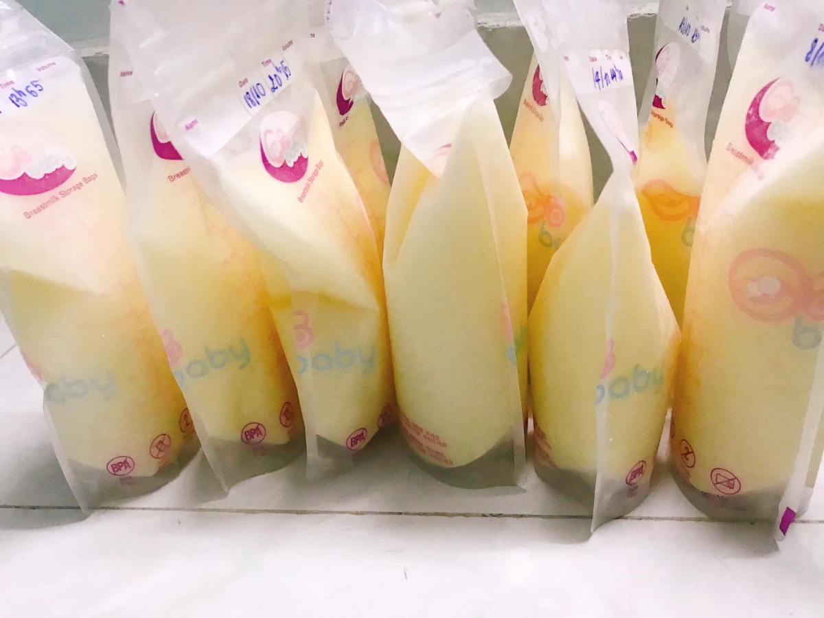 Review đi đẻ bệnh viện Hùng Vương 😀

Hút sữa xong cử 00:00 là e tỉnh ngủ, ngủ lại k được nên là buồn buồn viết bài review đi đẻ😌

13/09/2020 - Ngày mình gặp nhau đó Lavie à☺️

*** Thăm khám thai:
Từ đầu thai kỳ cho đến lúc vỡ chum e theo dõi bác sĩ tư, bác Hải Châu bv Hùng Vương . Bác hiền nhiệt tình, khám kỹ có điều lúc nào cũng đông nên là đi khám phải đi sớm nè.

*** Hành trình đi đẻ: 
Ngày 10/9/2020 e te te đi khám thai như bth, vô khám bs bảo nở 1phan về nhà theo dõi nếu tối có đau bụng thì vô bv ngay k thì mai quay lại khám tiếp, r mai quay lại khám thật tối đó khám xong bác kêu nhở 2phân r về nhập viện nha e, hỏng ai như e luôn sợ đẻ lắm hỏi bác mai sáng dc k, bác nói v thoi mai sáng cũng dc mà khuya có gì là nhập viện liền nha.

Xong về quyết định đi ăn cả thế giới, tối hôm đó vừa sợ vưa hồi hộp mà thấy sợ nhiều hơn nên là chẳng thể ngủ dc luôn.

Sáng hôm sau bs hẹn 8h nhập viện nhưng k 9h e mới dậy đi ăn sáng đồ thì đã soạn sẵn lúc tối r thế là 10h nhập viện, vô phòng nhận sanh bị la:
- ủa ủa khám thai mà đi đâu vô đây?
- dạ k chị ơi, e đi đẻ
- mấy tháng r mà đòi đẻ, ai kêu lên đây
- dạ e đi đẻ thiệt c, bác hải châu hẹn

Xong mới chịu cho e đẻ khổ ghê vậy😂😂 Thay đồ làm thủ tục xong e dc dắt lên phòng chờ sanh. đúng thật mới vô chưa đau bụng nên còn tung tăng lắm chụp hình tự sướng, đánh liên quân các kiểu, nhìn mấy chị kia đau rên mà mình ớn luôn, xong nghĩ chắc mình k đến nỗi v đâu 😅😅. Đợi tới 5h chiều vẫn chưa nở thêm đc phân nào cả. bắt vô khám trong và bị vỡ ói, ra truyền thuốc dục sinh thì ôi thoi chuyện gì tới cũng đã tới, nó đau thấy mấy chục ông mặt trời luôn chứ đừng nói là thấy 10 ông mặt trời. Chỉ biết nằm rên và thở đt thì dục 1 xó lunn, cứ mà gặp hộ lý nào đi ngang cũng kêu cho tiêm giảm đau nhưng k cho phải 3,4 phân mới đc tiêm😭😭😭. Chịu đau từ 17h đến 12h khuya thế là cuối cùng đã nở đc 3phan và đc gọi ck vô kí tên để tiêm giảm đau và cho vô phòng sanh.

Vô phòng sanh tiêm giảm đau xong thì mình lạnh và bngu kinh khủng, 1 phần đau quá nên cũng đuối. Trc đó nghe mấy mom khác review là tiêm giảm đau xong như là chết đi mà đc sống lại haizz e có thấy gì khác đâu, tiêm xong đang đau bụng lại dc bonus thêm đau lưng và đau 1 chân ủa là sao??? Nằm nhìn mấy mom khác sinh nào la nào khóc mà mình sợ thật sự luôn á, nằm đến 3h sáng bác khám trong vẫn k nở thêm dc phân nào, xong bác bảo thoi e ơi con e ngôi thai k sinh thường được r mổ nha e. Lúc này kiệt sức thật sự r gật đầu kiểu h bác muốn làm gì làm đi😂😂. 

Thế là bị đẩy đi mổ ăn cả combo đau đẻ và đau mổ oi thôiii. Vô phòng mổ lúc đầu là gây tê, bác vừa định rạch bụng mình vẫn còn cgiac, rồi k hiểu vì sao mình lại bị gây mê luôn. Ngủ 1 giấc k biết gì tầm 5,6h sáng mình dc đẩy xuống phòng hồi sức, nằm đấy đến 10h thì đc nhận con. Ẳm con lại chị ấy hỏi mình:

- Con em trai hay gái, nặng nhiêu kg e?
- Em đâu biết đâu chị
- Ủa sao kbiet e?
- E bị gây mê mà chị

Rồi chị đọc cân nặng và giới tính con, buồn thay ai cũng dc để con lên ngực, trc đó mình cứ nghĩ chắc khoảnh khắc đó nó thiêng liêng lắm, đc ôm con đc hôn con. Nhưng ko, chị ấy đặt con mình dưới chân😞😞😞. Nằm đợi đến 12h mình đc nhận phòng mẹ với con về phòng.

*** Tổng kết: 
Nhập viện 10h sáng ngày 12/9 xuất viện trua 12h ngày 16/9 nằm phòng 4 giường vì k còn phòng nào cả, cơm ngày 3 cữ đồ ăn ngon bị cái cử sáng mang lại rất sớm mới 5h sáng đã mang lại mà mình thì k có thói quen ăn sớm như vậy, phòng sạch sẽ, đc dọn vệ sinh mỗi ngày
Điểm trừ duy nhất là mẹ và bé nằm chung giường nhưng giường hơi nhỏ, khá là chật, gặp đau vết mổ nên là ngồi dậy và nhích ng thật sự rất đau. Và nếu đc e khuyên chân thành nếu có điều kiện thì nên chọn phòng 1 hoặc 2 giường thoi, vì ở chung nhiều ng, mỗi ng 1 ý gặp ng có ý thức thì k sao, như e ở cùng phòng với 2vc nọ con thì khóc miết k nín 1 giây phút nào kêu ra hỏi y tá bs xem sao thì k đi cứ để con khóc như vậy, đến khi con ngừng khóc thì đến 2vc nói chuyện đt um sùm cả phòng luôn, ở chung tập thể mà muốn chỉnh máy lạnh sao là chỉnh, thích thì tắt đèn k thích thì mở đèn ôi mình bực kinh khủng. 
Chỉ có vậy là điểm trừ thoi chứ

Bác sĩ, hộ sinh đều nhiệt tình nhẹ nhàng 💕

Tổng viện phí: 11trieu, mình tiêm thuốc kích sinh, tiêm mũi giảm đau, ở phòng 4g 800k, xông hơ vùng kín, gội đầu, tiền thuốc khi xuất viện ( mình đc hưởng bh 80% vì mổ cấp cứu trong vòng 24h)