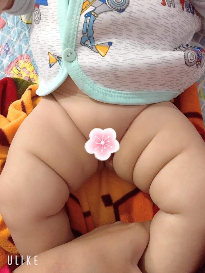 nhìn thế này thì liệu là trai hay gái thế mấy mom , mấy cụ nhà em bảo là trai liệu có đúng không ạ