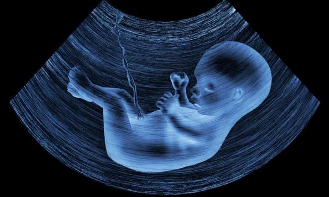 ***PHÁT HIỆN HẠT VI NHỰA TRÊN NHAU THAI Ở NGƯỜI ***

Một số hạt vi nhựa được phát hiện trong nhau thai của bốn phụ nữ đã làm dấy lên mối lo về rủi ro tiềm tàng đối với sức khỏe của các thai nhi, theo Guardian.

Một nghiên cứu công bố trên tạp chí Environment International lần đầu tiên ghi nhận sự tồn tại của các hạt vi nhựa trên cả mặt trông vào khoang ối lẫn màng đệm của nhau thai. Mẫu xét nghiệm được lấy từ bốn phụ nữ khỏe mạnh và sinh con bình thường.

Khoảng 12 mảnh vi nhựa đã được phát hiện từ bốn nhau thai nói trên. Tuy nhiên, vì mẫu xét nghiệm chỉ chiếm 4% diện tích nhau thai nên nhóm nghiên cứu cho rằng lượng vi nhựa thực tế còn cao hơn gấp nhiều lần.

Các hạt vi nhựa này có kích thước vào khoảng 0,01 mm, đủ nhỏ để lẫn vào mạch máu người. Nhóm nghiên cứu hiện nghi ngờ số dị vật này đã xâm nhập vào cơ thể các bé sơ sinh song chưa thể kiểm chứng ngay.
Kết quả phân tích cho thấy số vi nhựa nói trên có nguồn gốc từ các sản phẩm nhựa như bao bì, sơn, mỹ phẩm, dầu gội hoặc xà phòng.
Nhiều nhà khoa học cho rằng việc phát hiện ra lượng vi nhựa trong nhau thai ở người là "một điều đáng lưu tâm".

Tác động trực tiếp của số dị vật này đối với cơ thể người hiện vẫn là một ẩn số. Tuy nhiên, nhiều chuyên gia dự đoán số vi nhựa này có thể mang theo một số hóa chất gây tổn thương lâu dài hoặc làm rối loạn hệ thống miễn dịch đang phát triển của thai nhi.

"Hiện tượng này không khác gì các bà mẹ sinh ra em bé lai người máy cả", Giám đốc sản phụ khoa Antonio Ragusa tại Bệnh viện San Giovanni Calibita Fatebenefratelli ở Rome nhận xét. "Cơ thể em bé không chỉ bao gồm tế bào của con người, mà còn chứa chất tổng hợp sinh học và vô cơ nữa".

Nguồn: Zing News