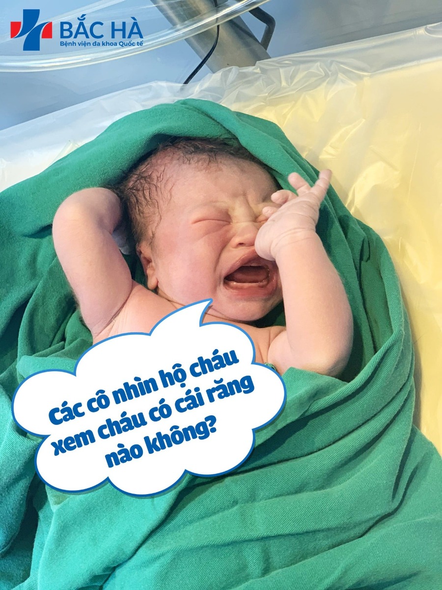 REVIEW SINH TẠI BV ĐA KHOA QUỐC TẾ BẮC HÀ

Thấy các mẹ review tâm huyết quá nên nhân lúc rảnh rỗi con ngủ e cũng ngoi lên có đôi lời thay lời cảm ơn tới bv Bắc Hà và bác sĩ Tiến Đạt 😍😍😍

Đăng ký từ 12w luôn và xác định là đẻ mổ vì lần 1 em cũng đẻ mổ rồi. Đợt em đăng ký giảm tận 35% cơ nên chênh có ít so với em đẻ lần 1 ở khoa yêu cầu PSHN😁. Mà em thấy quá sáng suốt vì khám thai, siêu âm, tiêm phòng, xét nghiệm đủ kiểu đều nằm trong gói hết rồi chứ như lần đầu em tốn quá trời tiền cho mấy cái đó luôn. Nên em thấy mẹ nào đã có ý định chốt gói thì chốt từ sớm sẽ tiết kiệm hơn nhiều ấy ạ👍

Nói chung đi đẻ ưng tất tần tật mọi thứ, từ cách chăm sóc của y tá, điều dưỡng đến các dịch vụ rồi cơm cữ,... Đặc biệt, gia đình e cảm thấy may mắn lắm luôn vì chọn đc bác sĩ giỏi, có tâm. Có mẹ nào trong nhóm cũng được bác Tiến Đạt mổ đẻ không ạ? 😆 Vợ chồng em biết bác Đạt từ hồi bác làm Phó khoa A5 bên PSHN cơ vì có duyên là bác mổ thai đôi cho chị ruột của em luôn ấy, mà đợt đó chị em mắc tiểu đường thai kỳ, thai to lại rối loạn đông máu nữa nên thuộc trường hợp sinh khó, mà bác Đạt mát tay lắm, đón mẹ tròn con vuông 🥳🥳🥳. Vậy nên, đợt này vợ chồng e quyết theo bác, biết bác làm bên Bắc Hà nên vợ chồng e đăng ký gói bên này luôn.

Đi khám lần nào bác cũng dặn dò từng tí một, kể cả những cái nhỏ nhất trong chế độ ăn uống trong thai kỳ, nhiều lúc còn thấy bác nhiệt tình như thể mình thuộc chế độ "con ông cháu cha" cơ 😁 Ngày lên bàn mổ lúc 38w4d, bác Đạt vào động viên từ lúc mình trong phòng chờ sinh, lần này thì không phải 1001 lời dặn dò nữa mà bác vào nói chuyện rất bình thường kiểu tếu táo ấy, mình cười nhiều tới nỗi quên mất là sắp phải mổ đẻ 😂 Lúc lên bàn mổ rồi, bác vẫn quay ra nói với mình "cứ yên tâm nhé, sắp được gặp con rồi". Trời ơi, cảm động suýt rơi nước mắt luôn. E thề là e không nói quá đâu, kiểu trong giờ phút thiêng liêng mà nghe đc những lời động viên như thế là ai cũng hay bị xúc động ấy🤧🤧🤧. Mà bác mổ nhanh bất ngờ luôn ấy, em còn đang đu đưa theo nhạc nghĩ trong đầu là "lên dây cót đẻ thôi nào" thì chưa kịp lên dây đã nghe con khóc rồi. Hiu hiu. Trong lúc bác Đạt khâu vết mổ cho em thì con em được đưa đi khám sức khỏe tổng quát xong quay lại 2 mẹ con áp da. Lúc đấy là em khóc thật luôn chứ k suýt như đoạn trên nữa. Mà bác Đạt mổ xong xuôi vẫn k quên hỏi thăm em, công nhận là bác lúc nào cũng nhẹ nhàng, ân cần lắm luôn 😍

Mấy ngày e lưu viện được các cô y tá, điều dưỡng chăm sóc như ng nhà, kiểm tra sức khỏe liên tục luôn. Và vẫn là bác Đạt no.1 đi đến hỏi han tình hình của em và vẫn không quên dặn em ti tỉ điều chắc bác sợ em đẻ xong não cá vàng quên nhanh nên lúc nào cũng phải dặn đi dặn lại 😁

Mà cái em tiếc nhất là em đẻ muộn 1 tí nữa thôi là có cái dịch vụ cho bố vào phòng sinh cùng rồi. Đợt này mẹ nào đăng ký là đc cho chồng vào cùng í. cho chồng vào để biết vợ hi sinh như thế nào chứ các mẹ nhể 😇😇😇

P/s: Nhân thể khoe với các mẹ là chồng em khen vết mổ "xinh", mảnh ơi là mảnh í, thế là lại phải khen bác Đạt thêm cái khoản khâu khéo nữa rồi. hihi 😂😂😂

Con sắp dậy rồi nên em xin dừng bút thôi ạ. Có mẹ nào cũng đc bác Đạt mổ thì cmt xem e review đủ chưa nhé ạ 😋
ĐĂNG ẢNH CON ĐỂ CÁC MẸ ỦN ĐÍT CHO CON HAY ĂN CHÓNG LỚN Ạ