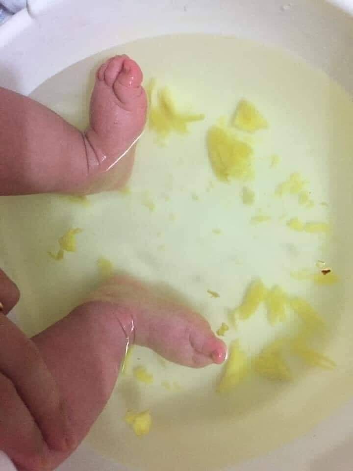 Gừng Nướng theo cách này, con ho, sổ mũi, rát họng đến đâu cũng khỏi hẳn sau 3 NGÀY

👉 Nguyên liệu:
- Gừng già: 50g
- Muối hột: 20g
- Nước: 1 lít
- Nồi, thau…

👉 Cách làm:
Gừng chọn củ già, gọt vỏ và rửa sạch dưới vòi nước.Cho gừng vào cối giã nhỏ, nấu chung với 1 lít nước và muối hột.Khi nước sôi thì vặn nhỏ lửa, để chừng 5 phút cho tinh chất gừng ra hết sau đó tắt bếp và để nguội khoảng 40 độ là có thể sử dụng được.

👉 Cách dùng:
Trước khi đi ngủ, mẹ hãy đổ nước gừng ấm vừa đun ra thau để ngâm chân cho bé, vừa ngâm vừa massage gan chân cho con, nếu mẹ biết huyệt dũng huyền thì bấm cho con sẽ có tác dụng nhanh hơn. Tuy nhiên, nếu không biết thì mẹ chỉ cần massage chân cho bé là đủ.

Cách massage: dùng ngón tay cái tì lên mu bàn chan của bé, các ngón còn lại bóp nhẹ vào gan bàn chân, đi dọc từ gót chân lên gần ngón chân.

Cũng có thể dùng gừng chà vào lòng bàn chân của bé.Khi nước hết ấm, mẹ lấy chân con ra đặt vào khăn sạch, lau khô 2 chân con xong nhẹ nhàng massage bằng dầu khuynh diệp hoặc dầu tràm đều được để dầu thấm và lan tỏa vào các huyệt đạo ở chân bé. 

Sau đó mang vớ chân cho con rồi đi ngủ.Kiên trì sử dụng đều đặn mỗi ngày một lần, trong 3 ngày liên tiếp các triệu chứng ho, sổ mũi của bé sẽ khỏi hẳn.

Nguồn: Sưu tầm