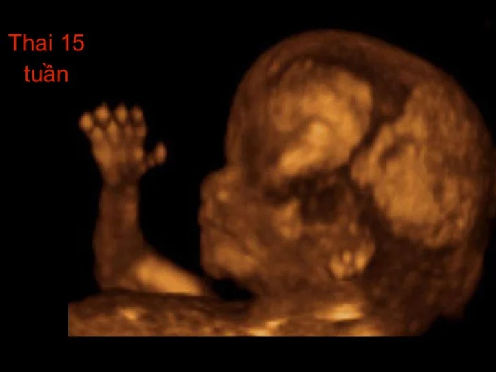 Hình ảnh siêu âm thai 15 tuần