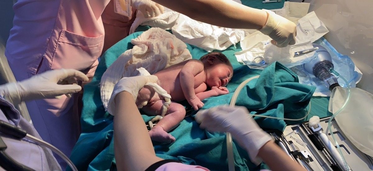 Cách đây ít phút tập thể YBS BV Hùng vương lại thêm một lần nữa   giúp một sản phụ vượt cạn thành công khi mà gianh giới sinh tử chỉ còn mong manh như sợi tóc! ...  Lúc gần 9g sáng  ngày 3/12 sản phụ Đặng thị thi H  mang thai lần thứ ba  Vào phòng cấp cứu trong trạng thái chuyển dạ, đau bụng, vỡ ối sớm ,  khám sơ bộ khi Chưa cần làm bất cứ kỹ thuật CLS nào các Bs đã nhận định đây là một tai biến đặc biệt nguy hiểm mà bà mẹ và em bé  đang  phải đối  mặt, tai biến do quá trình chuyển dạ dây rốn lọt xuống trước và mắc kẹt , trong sản khoa thường gọi là sa dây rốn, việc cấp máu và oxy cho thai nhi bị ngừng trệ đột ngột, trong tử cung tim thai chỉ còn đập rời dạc , xác định đây là một trường hợp cấp cứu tối khẩn cấp, các BS kích hoạt báo động và đưa ngay sản phụ lên phòng mổ khi chưa kịp khai thác đầy đủ thông tin và chưa làm đủ các xét nghiệm cần thiết cho một cuộc đẻ hoặc cuộc mổ,  do sự phối hợp cực kỳ ăn khớp giữa bs gây mê hồi sức , bác sỹ sơ sinh, phẫu thuật viên ...nên chỉ chưa đầy 5 phút sau tại phòng mổ kíp phẫu thuật đã  lấy ra một bé gái    trong trạng thái tím tái, suy hô hấp ,    tim đập rời dạc . Tuy nhiên do thời gian bị ngừng cấp oxy chưa dài nên sau ít phút cấp cứu , sơ sinh đã hồi tỉnh, khóc tốt , các chỉ số sinh tồn ( apgar)ổn định, tại thời điểm này có thể nói ,  cuộc cấp cứu  mà có lẽ hơn thế nữa nó gần như một cuộc chạy đua khốc liệt , một chận chiến sinh tử đầy kịch tính đã thành công , cả mẹ và sơ sinh đang dần ổn định...
-- BS Hoc Pham