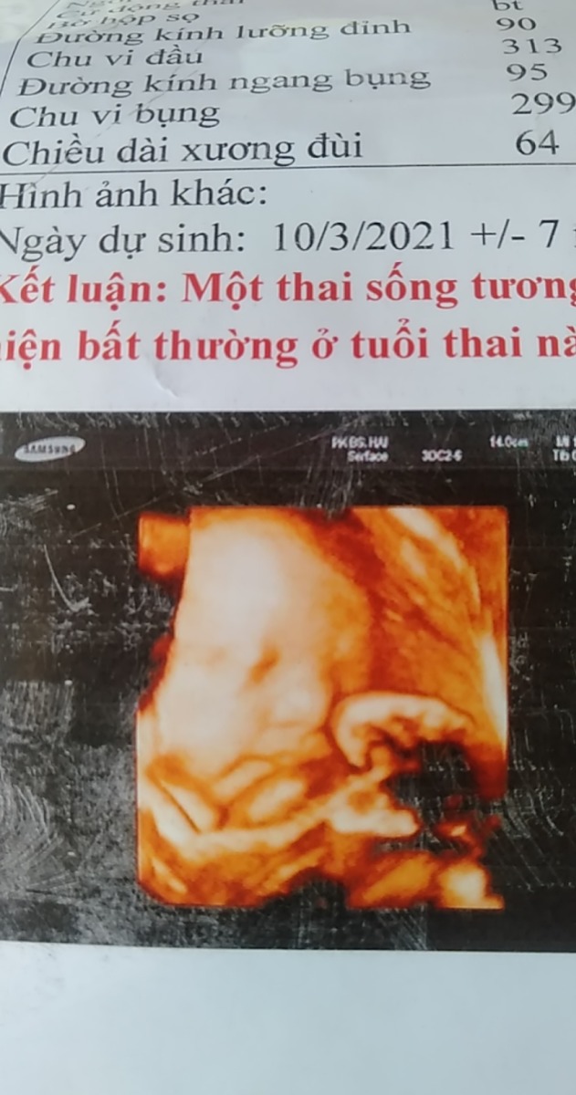 Mình mang thai đc 34 tuần, mà sao mỗi khi mình làm việc đứng có tí lại khó thở là sao các mom ah
