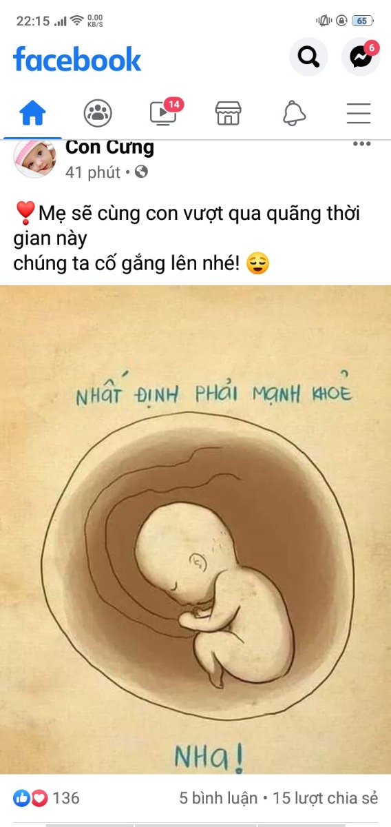 Các mẹ cho e hỏi có mẹ nào đi s.a mà 2 nơi ra 2 kết quả cân nặng của bé khác nhau k ạ 
29w4d e s.a trvia bé 1k5 tại pkham e hay khám
30w6d bé dc 1k9 tại viện
Nhưng nay 32w2d thì dc có 2006g tại pkham e hay khám
Mẹ k bị tdtk,bsi bảo cân nặng chuẩn k to k nhỏ,nhưng e lại thấy sự chênh lệch mấy ngày khám chênh nhau nhiều quá hx