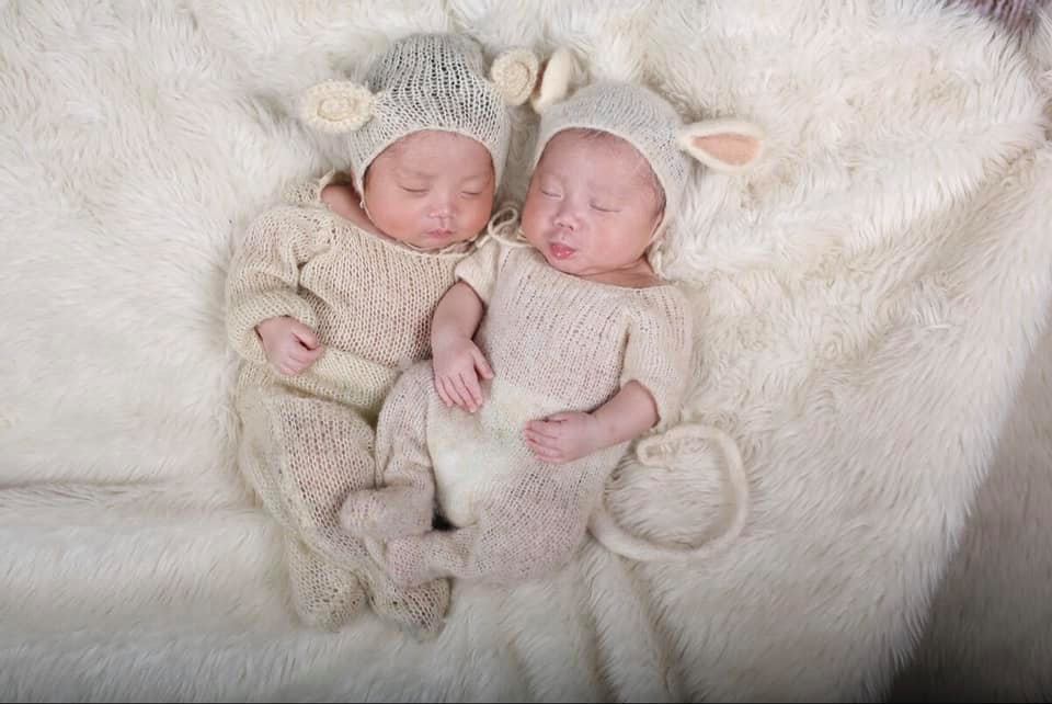 Mẹ con e đã về đích lúc 33w5d tuy k gọi là thành công rực rỡ như mọi người, nhưng đối với bản thân e đã gọi là may mắn nhiều nhiều lắm rồi ạ 😍

E lấy Ck từ năm 19/01/2012(AL)tới lúc e sinh 2 con là 11/09/2020(AL) thì các c tính xem em hiếm muộn bn năm ạ😣 Từng ấy năm trôi qua em đã khóc k biết bao nhiêu lần trải qua bao đau đớn nữa tất cả 4l chọc trứng và k biết tiêm bn mũi tiêm đủ thứ thuốc vào người rồi cũng đã làm đủ mọi cách mới có bầu được mặc váy bầu được cảm nhận lần máy nhẹ đầu tiên của con mà bao năm nay e đã mong muốn, e đã hái được  2 trái ngọt như ngày hôm nay thật sự e rất hạnh phúc các c à 😍👩‍👦‍👦

Em mang bầu trộm vía mẹ khỏe con khỏe mỗi lần đi siêu âm được nhìn thấy con nghịch trong bụng e thấy vui lắm e còn quay lại video về nhà e xem đi xem lại k biết bao nhiêu lần, tới tuần thai 25 e xn dung nạp đường lúc đi vui vẻ bao nhiêu lúc về e lại buồn và lo lắng bấy nhiêu, e bị cao luôn 3 chỉ số 7.29.14.20.14,29 bsi bảo e nhập viện nội tiết ngay k nguy hiểm tới e bé e lo sợ lắm ngày nào cũng nên hội xem các c chia sẻ xem thực đơn ăn uống như nào để e ăn theo sau đó e nằm viện BM 1w điều chỉnh để dò liều để tiêm insulin đường vẫn loạn k ổn định vì bsi của e nói e dễ bị tđ trước rồi e lại buồn hơn nữa nhưng e đã cố gắng k suy nghĩ ăn uống thật tốt để 3mc ổn định nhưng e lại dư ối và đa ối nữa e vẫn tiêm isulin liều 9-9-9-14 tới tận lúc e đi sinh 😣 e bị rỉ ối như vỡ ối luôn các c ạ mà siêu âm bsi bảo e nước ối vẫn mênh mông lắm nên e đỡ lo e bị lúc 32w5d e nằm viện pstw đúng 1w là con gò nhiều đòi ra ctc còn 1p thui bsi bảo thai đôi giữ tới được tầm này là ổn lắm rồi cho đi mổ gấp e đã khóc e run e sợ vì sợ sinh con bé tội thương con 😭 thế là y tá đẩy e đi nên phòng mổ chưa đầy 10p 3mc e đã gặp nhau các c ạ thấy con khóc to bsi bảo trộm vía mỗi bé được 2kg thế là bsi cho e nhìn 2 con thực sự lúc đó e đã rơi những giọt nước mắt ho các c ah e thầm nghĩ e đã làm được làm mẹ thật rồi 🥰 thế là c y tá bế con e đi vào khoa ss để theo dõi anh hôm sau được về với mẹ luôn còn e thì phải thở oxy 1w và dùng kháng sinh ổn định bsi gọi tới đón con về trộm vía 2 bé nhà e xn máu gót chân bt hết ksao ạ giờ 2 bé nhà e được 1w20d rồi e mới ngoi lên than thở vài câu hihi e viết hơi lủng củng các c đọc có gì thông cảm cho e nhé