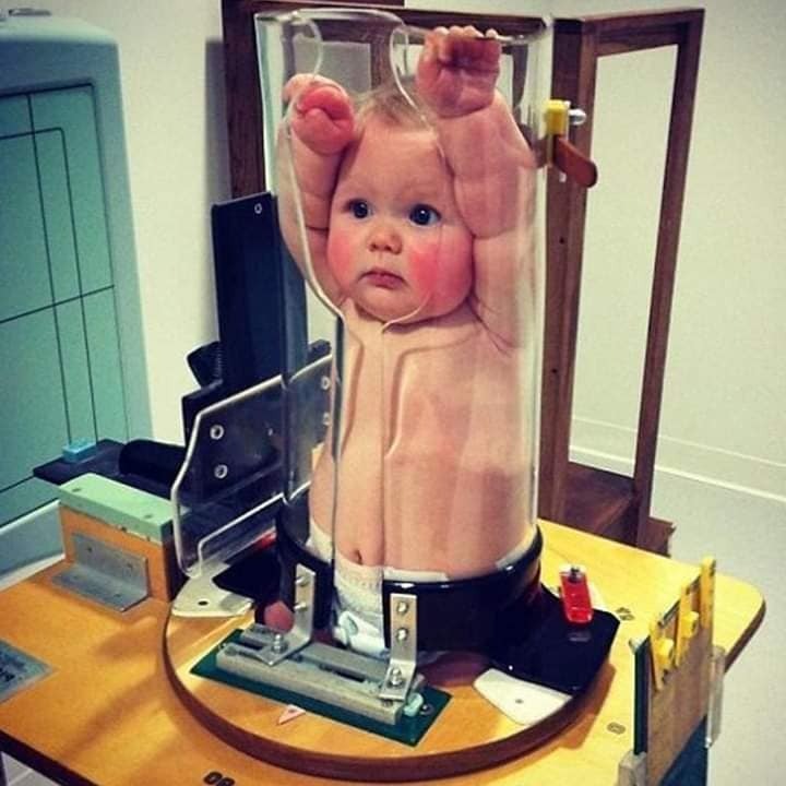 Khi bé chụp X-quang, tính phóng tui lên vũ trụ hay gì 😅😂🤣