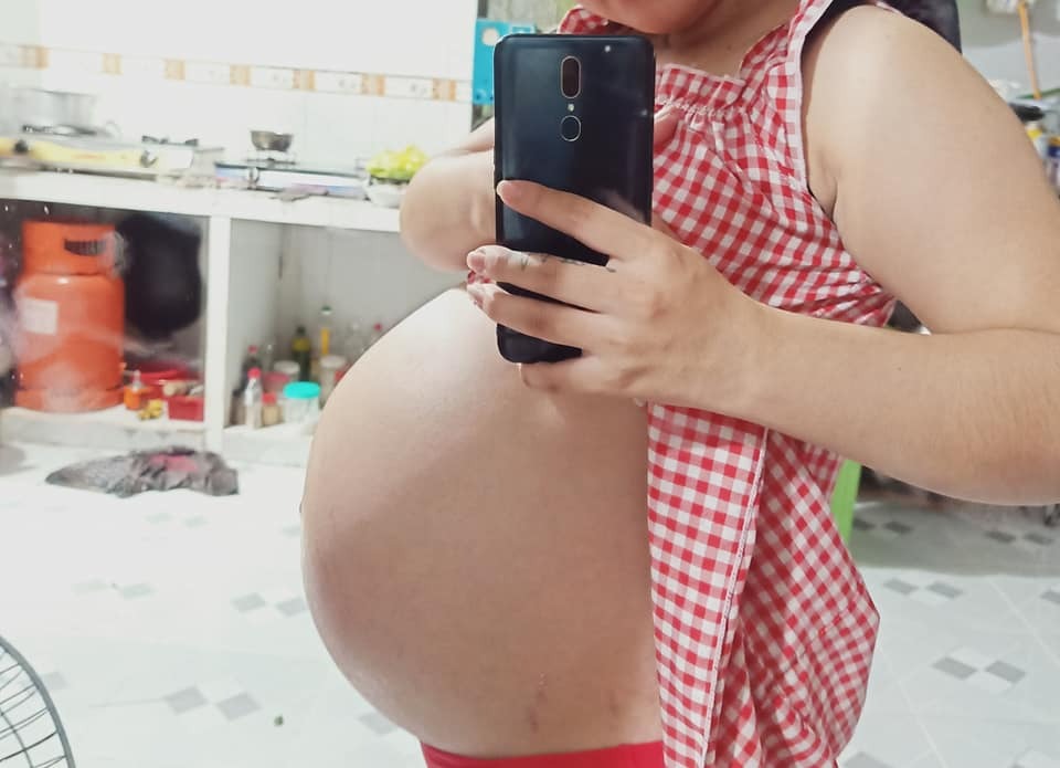 37w1d😍 ngôi mông( ngôi ngược)😭, con được 2810g❤  Có mom nào giống em không huhu.... Bác sĩ nói 98.99% là ăn dao🥺