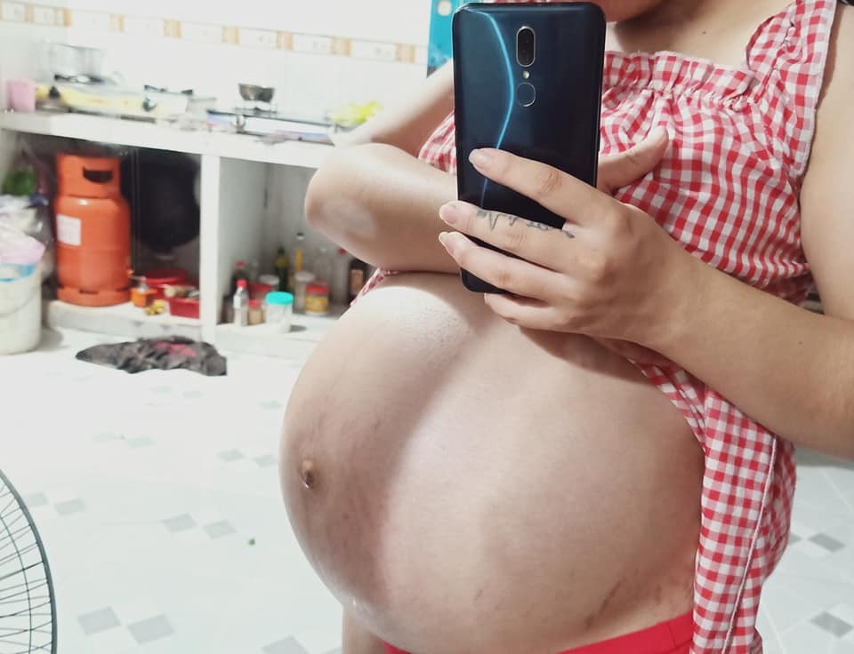 37w1d😍 ngôi mông( ngôi ngược)😭, con được 2810g❤  Có mom nào giống em không huhu.... Bác sĩ nói 98.99% là ăn dao🥺