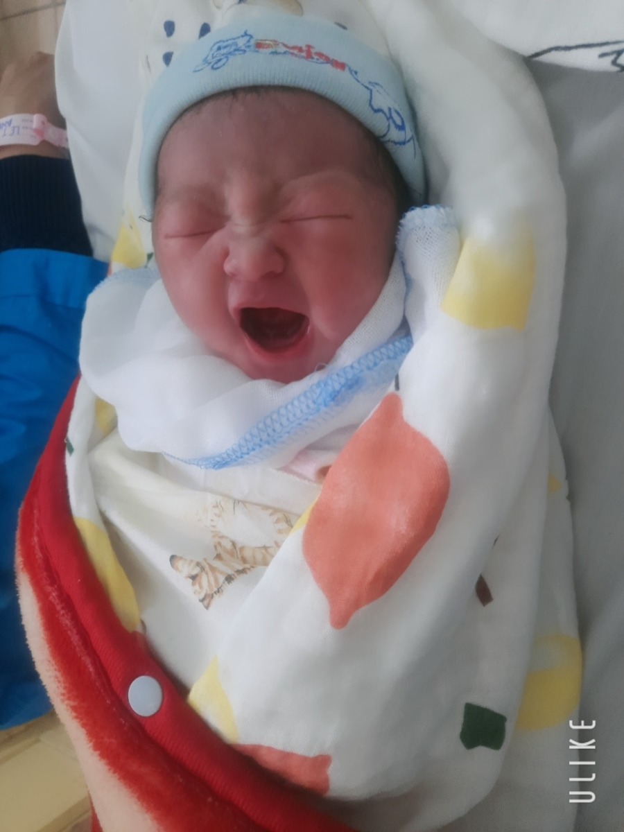 Sau hơn chục ngày ở cữ thì nay em ngoi lên 1 tí để review chút ít khi đẻ tại bệnh viện 103 ạ. Bé em sinh năm 2017 là bé đầu tiên, là ca chuyển dạ khó vì nhập viện khi bé được 37w5d trong tình trạng mở 5p mà không bong nút nhầy, không có máu báo, chưa vỡ ối và không có cơn đau mạnh. Mẹ thì khung xương chậu hẹp, bụng cao nên lên bàn đẻ gần 2 tiếng đồng hồ mới sinh được. Bé được bác sĩ Dũng đỡ cho ạ. Bé thứ hai sinh năm 2021 vào 24 Tết vừa rồi. Em nhập viện khi có cơn đau nhẹ, vợ chồng khăn gói đi đẻ lúc 12 rưỡi đêm tới nơi đã mở 4p nhưng vẫn chưa vỡ ối. Lần này tách ối xong em đau thấy Tổ quốc luôn, đi lại vài vòng thì em xin lên đẻ. Bs khám rồi nói em mở tốt nhưng cơ địa vẫn không phải dạng dễ đẻ. Ấy thế mà đau quá em rặn 4 hơi là bé ra. Bs đỡ cho em là bs Linh và chị Trang.
Cả hai ekip đỡ đẻ cho em đều rất nhiệt tình và động viên em cố gắng đẻ thường. Trộm vía 2 bác sĩ đỡ đẻ mát tay nên 2 bé nhà em đều ăn ngủ ngoan, không khóc dạ đề ạ.
Một lần nữa em xin chân thành cảm ơn 2 ekip đỡ đẻ của viện đã giúp em 2 lần mẹ tròn con vuông, hoàn thành xuất sắc nhiệm vụ 4 năm 2 đứa đủ nếp tẻ. Chúc các mom có dự định sinh tại viện 103 đều mẹ tròn con vuông ạ!
P/s: Ảnh gái út nhà em sau sinh vài tiếng ạ!