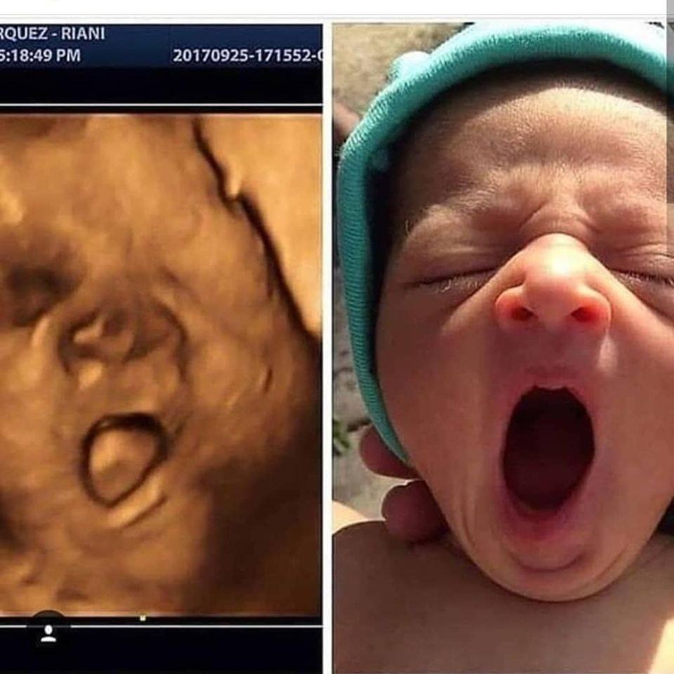 Trong bụng sao, ngoài y vậy luôn nha, hổng sợ nhầm đâu!
Nhiều mẹ đúc giỏi thật 😅😅