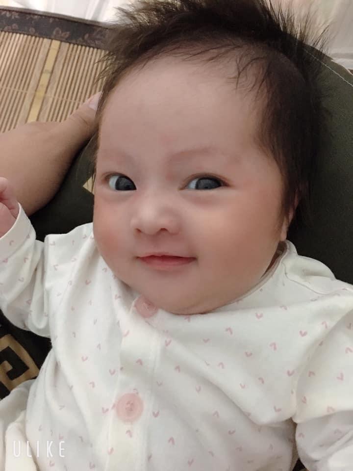 Bé em đc 4m rồi, bé ngủ hay dụi mắt,bấu mặt vò tai rồi lắc đầu liên tục.các mom cho e hỏi bé bị sao vậy ạ