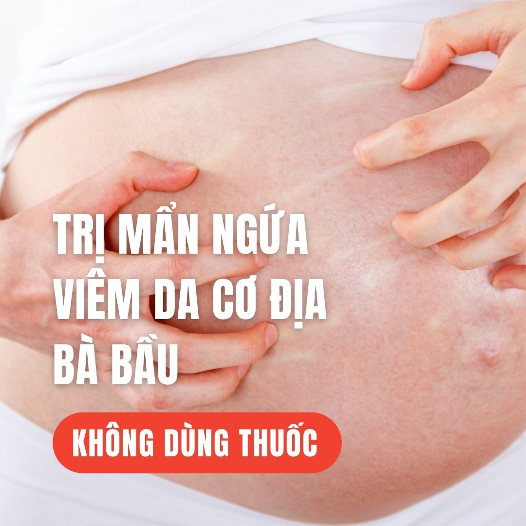 TRỊ MẨN NGỨA VIÊM DA CƠ ĐỊA BÀ BẦU

Xin chào các mẹ, khi mang bầu, nếu mẹ bị mẩn ngứa khắp người thì có thể thử cách sau nhé, hoàn toàn không có hại gì đâu ạ

Đó là tắm bằng nước ấm pha với muối mỗi ngày. Mẹ nêm nhạt hơn nước canh ăn một chút (mặn quá thì sẽ mất tác dụng).

Đơn giản vậy thôi ạ, mẹ có thể thử luôn vào buổi đi tắm ngày hôm nay nhé
