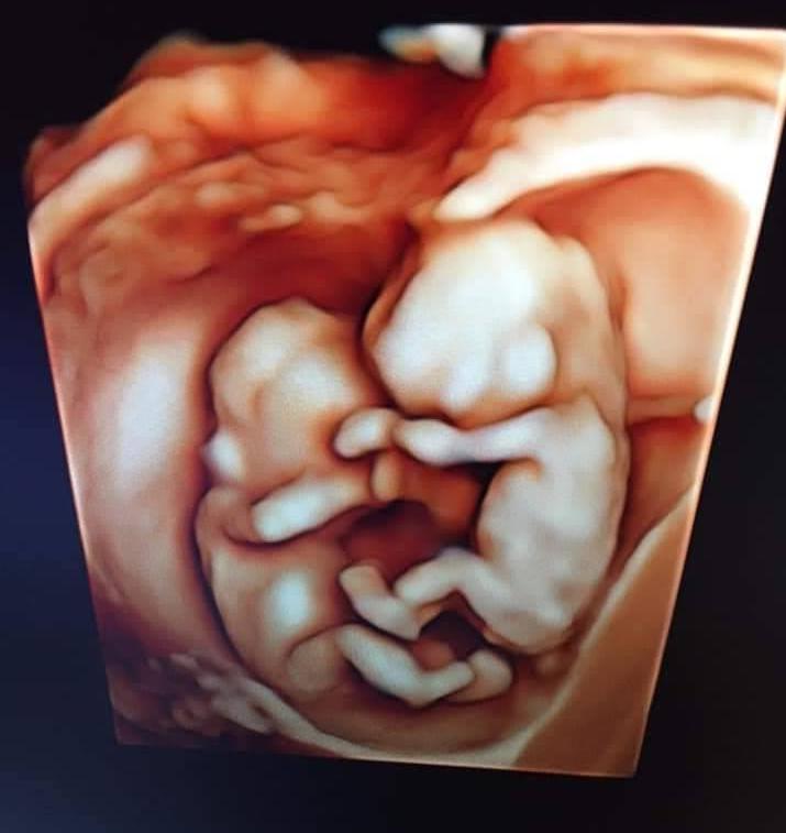 Đây la 1nang 1 chàng trâu của nhà mình đây ạ, 22w 450g va 500g
Cảm ơn Mamibabi rất nhìu á, mẹ thai giáo là 2 con trâu con ngí ngoáy luôn ạ
Các mẹ có thai giáo cho các bé ko?