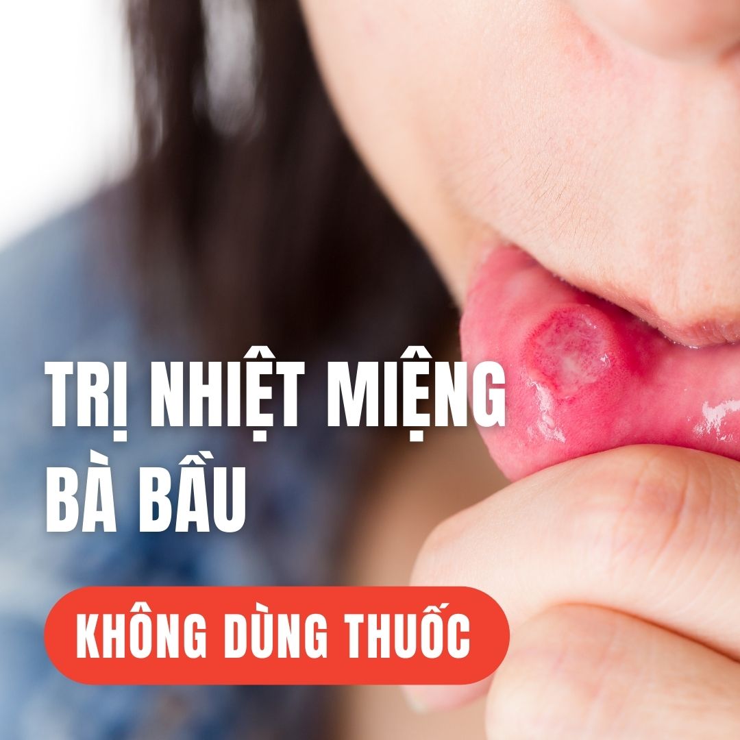 TRỊ NHIỆT MIỆNG BÀ BẦU KHÔNG DÙNG THUỐC

Xin chào các mẹ, không chỉ các mẹ bầu mà ngay cả người bình thường khi nhiệt miệng cũng rất khó chịu phải không ạ.

Hôm nay mình sẽ chia sẻ một cách chữa nhiệt miệng rất đơn giản và hiệu quả, lại hoàn toàn không có hại gì.

Đó là mỗi khi bị nhiệt, mẹ lấy hai quả cà tím dài, cắt lát mỏng, sau đó luộc trong 10 phút để lấy nước uống. Tối đến khi đi ngủ thì ngậm thêm 1 thìa mật ong.

Mẹ chỉ cần làm từ 1-2 lần là vết nhiệt sẽ giảm đau đến 80%, làm thêm 1 vài lần nữa thì sẽ hết hẳn.

Nước luộc cà tím dài có công dụng chữa nhiễm siêu vi đường miệng còn mật ong có tác dụng thông kinh hoạt lạc và trị nấm rất tốt, đó là lí do mà đây là cách trị nhiệt miệng rất hiệu quả. 

Mẹ hãy thử ngay nhé, hoàn toàn không có hại gì đâu ạ!

Nguồn: Sách Chữa bệnh thật là đơn giản - NXB Hồng Đức