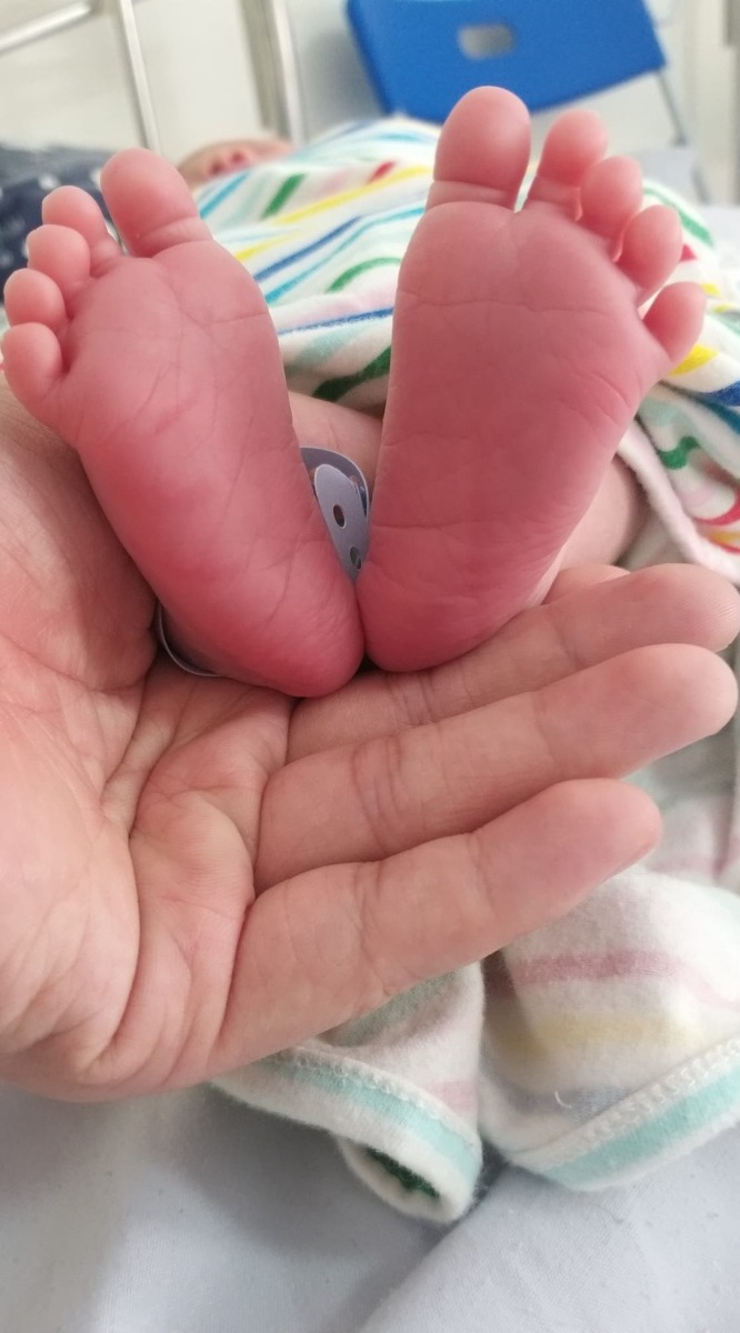 Review sinh thường viện 103
Cho mom nào sắp sửa sinh quanh Hà Đông chắc 103 là lựa chọn tốt nhất trong số viện công .
E đến ngày sinh mới vào viện kiểm tra vì ko có dấu hiệu gì. Lại thêm tập 1 cũng sinh quá ngày nên khá là tưng tửng. Tròn 40w mới lóc cóc vào viện khám và để làm hss luôn.
Vào khám thì đã mở đc 2 phân. Bs chỉ định nhập viện. Lúc đấy e mới đi làm xét nghiệm lấy máu, nc tiểu, điện tim các thứ xong xuôi thì là giờ trưa. (Các mom đừng như e) Vẫn k có biểu hiện gì nên về nhà ăn trưa ngủ 1 giấc 3h chiều mới đi nhập viện 😂
Viện mới xây rất sạch sẽ. Nhưng đang trong quá trình setup nên thiếu kha khá ạ. Tạm thời là chưa có cây nước đâu nên mẹ nào sinh trong tg này trc khi đến viện cbi nc lọc và nc nóng luôn nhé. À nc nóng hình như có bán e hỏi mấy c giường bên nhưng lúc ý tiện ck về nhà nên lấy luôn. Đồ ăn vặt cũng cbi luôn để lúc sắp đẻ thì ăn cho no chứ viện rộng vào đến nơi lại quay ra mua thì hết hơi lắm.
Trộm vía chắc bạn nhà e thương mẹ đến khi mở 4p rồi vẫn ko thấy đau bụng hay ra máu gì.
E còn tưởng chưa đẻ đc ngay. Cũng hết vía vì sợ k đau đẻ thì ăn dao.
8r tối bs cho đi chọc ối. E thắc mắc khá nhiều nào là sao k để e tự vỡ ối 😂 e sợ vỡ ối rồi e mở chậm thì k đẻ thường đc... bla bla.. nhưng bs vẫn giải thích nhẹ nhàng 😂 chứ gặp bs khác chắc ăn chửi te tua rồi vì toàn thắc mắc chuyên môn của bs
Kích ối xong thì bắt đầu đau. 9h hơn đau quá mới vào phòng đẻ thì 10h con ra rồi.
Vừa sinh vừa đc bs xoa tay động viên.
Sau sinh bs khâu thẩm mỹ tsm luôn cm ạ . E quên hỏi kb khâu vậy có ảnh hưởng đến lần sinh sau ko. Vì e vẫn nửa muốn thêm tập 3 nữa 😂
Lan man quá thôi thì Tổng kết ý chính cho mom nào lười đọc nha:
1. Về chi phí: e có bhyt trái tuyến. Nên chỉ đc 40% thôi. Tiền sinh hết 900k. Tiền làm hss và siêu âm hơn 600k bhyt ko trả khoản này ạ. Sau sinh siêu âm 100k (ngoài bhyt) Siêu rẻ. Ko nghĩ viện tuyến tw lại có mức cp này đâu cm ạ. Nhưng e cũng k hiểu sao e nhập viện và sinh trong ngày mà ko đc hưởng cấp cứu 80% :((
2. Viện k có phòng yêu cầu. Chỉ có nếu ng nhà muốn có giường riêng thì đky thêm 200k 1 ngày. Sử dụng luôn giường của phòng bệnh
3. Sau sinh khâu tsm đc tiêm tê nha cm. Nên khỏi lo. Nhưng lắm mũi khâu vẫn đau phát khóc luôn ý. Hichic
4. Có được da tiếp da với con sau sinh
5. Gói đẻ sạch 150k thì đc vsinh vùng bkn. Tháo thụt. 400k thì có thêm bỉm mẹ bỉm con quần áo con. E cbi sẵn rồi nên chỉ đk gói 150k
6. E thấy có dv plasma nhưng mà đẻ xong e về sớm nên quên hỏi. 10h tối hôm trc sinh xong thì trưa hôm sau e ra viện luôn rồi.
7. Viện có lấy máu gót chân miễn phí 2 bệnh thelasemia và 1 bệnh nào nữa ấy. E về sớm lại vướng t7 cn k thì cũng ở lại để lấy cho con. Mẹ nào ở viện 2 3 hôm thì nhớ lấy máu nhé.
💗 Rất cảm ơn ekip bác sĩ đã giúp 2mc em vượt cạn thành công. Mà ko mắng e câu nào 😂 chắc e là sản phụ nhiều chuyện nhất ấy cứ thắc mắc tỉ thứ trên đời và còn hay kêu ca nữa
P.s: trộm vía e cũng diện dễ đẻ. Rút sợi dây kn từ tập 1. Kinh nghiệm là nên tập hít thở khi đau đẻ cũng đỡ đau khá nhiều đấy. Thứ 2 là trc khi sinh nên ăn thật nhiều để lúc vào phòng sinh có sức rặn nha. T3 là tập mấy động tác mở rộng vùng chậu trc khi sinh vài tuần cũng có ích lắm ấy.
Chúc cm mẹ tròn con vuông nha.