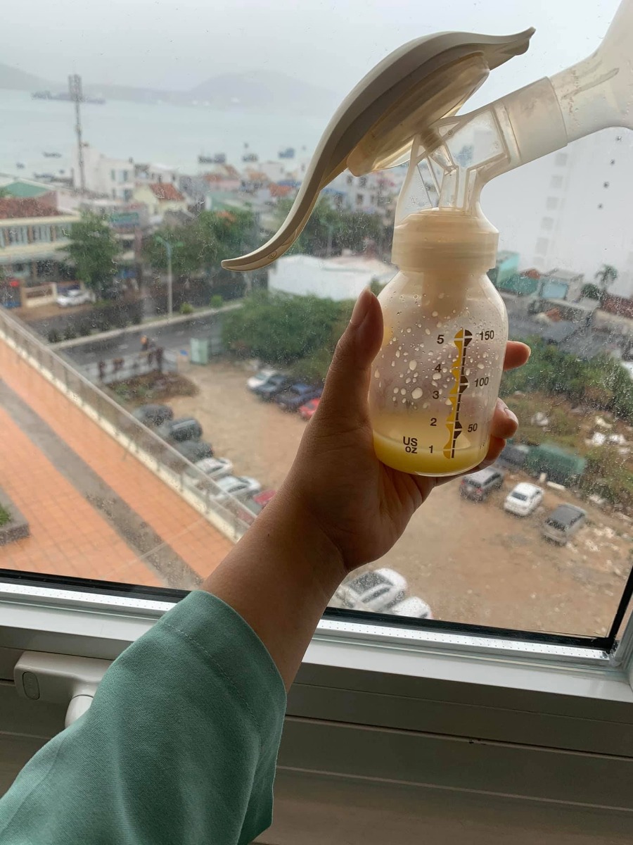 Hôm nay mình mới có time rảnh xíu để lên đây review cho các mom về dịch vụ ở Vinmec Nha Trang vì mình nghĩ có nhiều bạn sẽ cần tham khảo.
-Mình quyết đinh sinh ở Vinmec Nha Trang vào tuần thứ 31 vì vậy mình không mua gói với lại mình ở Phú yên nữa nên ra vô không tiện.Tuần 31 mình vào thăm khám mốc quan trọng cuối cùng được 1 chi gioi thiệu khám bác Uyên.Bác rất nhẹ nhàng tư vấn nhiệt tình vì mình sinh mổ nên chắc chắn l2 cũng sẽ mổ.Vì mình ở xa nên Bác hẹn w36 minh vào khám lần nữa và làm các xett nghiệm mở hồ sơ sinh luôn.Bác có hẹn là tầm w39 trở đi là mình vào mổ nhưng hỡi ôi mới có 38ư5d là cu cậu đã đòi ra rồi.
-2h chiều hôm đó mình đau lâm râm va thỉnh thoảng co cơn gò nhẹ mình đi siêu âm ở gần nhà bs bảo mổ đuoc rồi nuoc ối cặn voi đầu em bé tụt sâu rồi.4h chiều mình gọi bác Uyên bác bảo em vào nhập viện đi lúc đó mình cũng hoang mang tuy muốn bác Uyên mổ nhung nếu yêu cầu bs mổ thì tốn đến mấy triệu nữa nên mình nói thôi hên xui vô trúng ca truc bác nào bác đo mổ cũng được vì ở Vin bác nào cũng giỏi mà.Xui là chiu đó các vé xe đều hết vì hôm đó là chủ nhật voi mình nghĩ cũng chưa đau j lắm nên chủ quan đi tàu(khúc này nghĩ lại thấy cũng gan) vô đến nơi là gần 9h đêm,đặc biệt trên đường vô mình có nhắn tin cho chị Hạnh va đuoc hổ trợ rất nhiet tinh nên khi mình vào thẳng cấp cuu khai tên là các y tá biết ngay là đã đuoc báo rồi.Mình đuoc ngồi xe lăn đẩy lên khu sản.
-Vào đây đuọc đo cơn gò và làm thủ tục tạm ứng nhập viện mình có hỏi chị y tá là tối nay Bác nào trực thì c ý nói bác Hoàng nhưng bác Uyên sẽ mổ cho chị lúc đó mình mừng lắm luôn.Mình đươc vào nhận phòng thụt rửa vệ sinh sạch sẽ thay đồ,bvien tặng cho 1 túi đồ to đùng sịn sò gôm:quần áo bao tay chân của nouse,khăn ủ,khăn sửa,khăn uot,xà phòng tắm gội bé,đồ của mẹ nói chung gần như đầy đủ cả ko phải dùng cái j của mình ngoài bình sữa.10h bác Hoàng vào khán trong thực sự rất nhẹ nhàng lun ko đau như tập 1 mình sinh ở bv tỉnh bác bảo mở 1 phân rồi 30ph nữa mổ nhé.Mình đuoc đẩy cả giuonng vào phòng mổ gặp các y tá và bs gây tê mặc dù là 10h30 đêm nhưng ekip làm việc rất vui vẻ nhanh chóng và chuyên nghiệp khi mọi thứ xong xui thì bác Uyên vào và mổ cho mình rất nhanh chóng em bé ra khóc oe oe đặc biệt mình còn đuoc xem khoảnh khắc mổ lấy bé ra luôn thiêng liêng lắm ạ ck mình ở phòng chờ cũng co tivi và được thấy đoạn này luôn nhé.Mình mổ ra được da kề da voi bé cho bé mút ti mẹ 1 xíu sữa non về luôn chứ k như tập 1 3 ngày sau moi có sữa.Nằm hồi sức 1 tiếng đuoc tiêm mũi gây tê vuông thắc lưng dặc sản của Vin rồi đẩy về phong gap con.Phải nói là lúc này khoẻ lắm ạ mình còn nghĩ mổ khoẻ vày làm tập 3 cũng dc nữa.Trên giuong có 1 chuồn bấm cần j cứ bấm la các cô y tá sẽ vào hổ trợ ngay bất kể lúc nào.Vì sinh trúng dịch nên chỉ đuoc 1 nguoi nhà chăm nhưng vk ck mình vẫn nhàn tênh vì các cô o đây cần j la co ngay hướng dẫn nhiệt tình luôn.Cơm viện thì rất là ngon thực đơn phong phú.Hàng ngày các cô tắm bé tại phòng,có bác sĩ tới thăm khám cho mẹ và bé.Đặc biệt mình ko phải tiêm bất kì muỗi kháng sinh nào trong khi tập 1 ngày tiêm 2 mũi tiêm đến 7 ngày o viện mình ám ảnh luôn.Ở đây lúc hết thuốc tê mình co đau 1 xíu thì đuoc truyền 1 chai giảm đau sau đó còn đau nưa thì uống thuốc efanagan.Chỉ đau và thốn nhất lúc ngồi dậy tập đi thôi còn tất cả đeu nhẹ nhàng.Nằm viện 4 ngay là mẹ con khoẻ ru và xuất vien thôi.
-Về chi phí thì mình sinh mổ lần 2:sử dụng giảm đau cơ vuông và bắn tia plasma tất cả là 28tr vì mình có thẻ bh bảo việt của cty nên đuoc bh bảo lãnh chi phí mổ và nằm viện hết 21tr rồi mình chỉ mất 7tr thôi.
Đẻ ở Vinmec đúng thiệt là như đi nghỉ duong ở 5 sao luôn các mom ạ.Đặc biệt em cũng cảm ơn chị Hạnh đã takecare em rất nhiều từ trước trong và sau khi ra viện nhé!