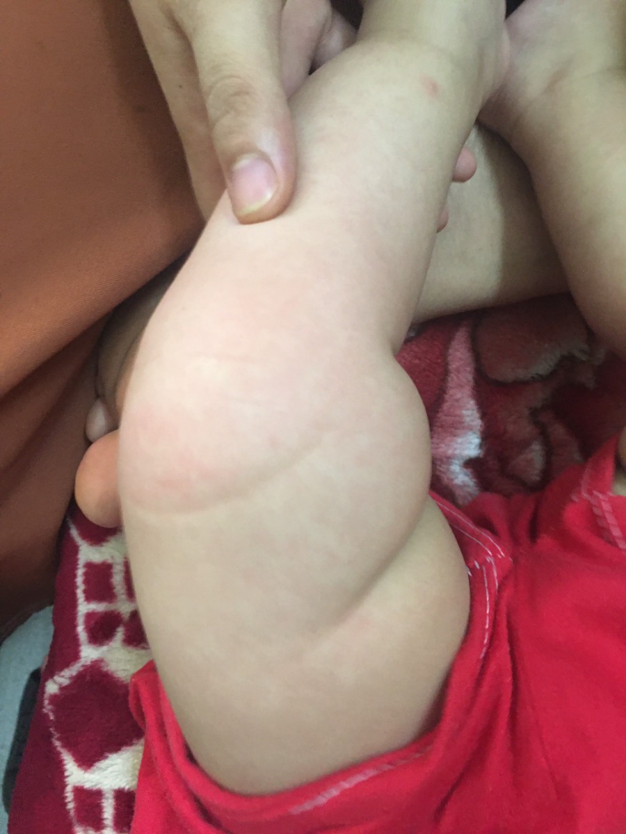 Các mom cho e hỏi.bé nhà e bị mẩm đỏ nhưng k sốt là bị gì và cách chữa như thế nào ạ.e cảm ơn