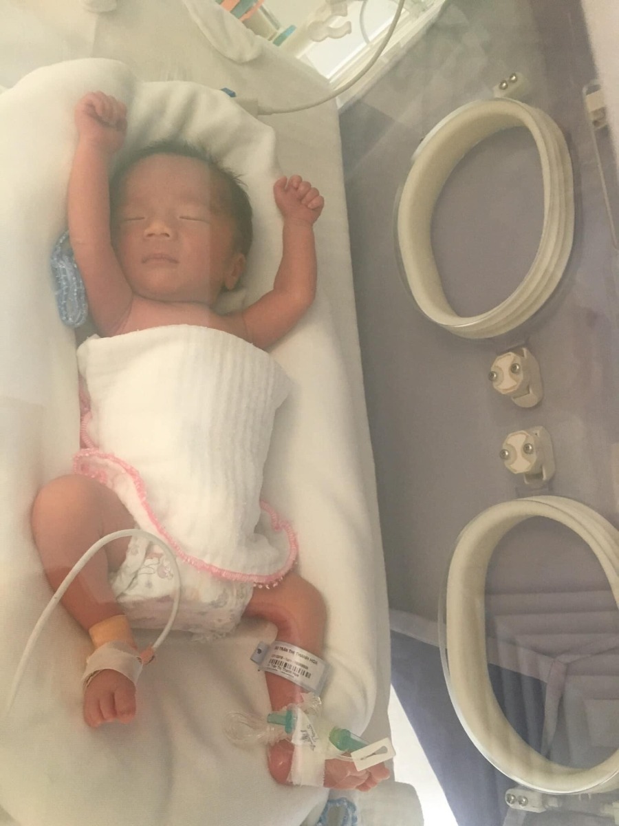 Tâm sự và chia sẻ về sinh non và sinh mổ ở Vinmec Times City Ha noi 
Em chỉ mới và định có một bé thôi mà vô group này làm em có động lực sinh thêm quá ạ ( truớc đây em rất muốn có nhiều bé nhưng do sinh mổ + sinh non lại thêm quá trình chăm bé khiến em thay đổi). Nhiều mẹ có 3 bé trở lên thực sự khiến em ngưỡng mộ và tò mò làm thế nào các mẹ có thể chăm nhiều con cùng lúc được thế? ( em 1 đứa đã chiếm hết thời gian của em rồi 😭 ) . Xin các mẹ chia sẻ và cho em xin kinh nghiệm với ạ? 
Còn đây là tâm sự của em về chuyện sinh non và sinh mổ ở Vinmec Times City Ha noi 
Cả thai kỳ em hoàn toàn khoẻ mạnh, hoạt động sinh hoạt như bình thường, ăn uống ngon miệng, đi du lịch, yoga, kiểm tra gặp bác sĩ theo lịch hẹn đầy đủ. 
Vậy mà, đến tuần 34 của thai kỳ em đi khám thai bác sĩ trưởng khoa Vinmec ( bs Nghĩa ) bác còn khen em và em bé phát triển rất tốt, em bé quay đầu, khung xương chậu phù hợp sinh thường còn bảo em kiểm soát cân nặng bé đừng để to quá khó sinh. Và ngay tối hôm ấy khoảng 10 giờ em vào toilet trước khi ngủ thì bỗng dưng nước xối xả chảy xuống, em hốt hoảng nghĩ thôi chết xong rồi ( vì em có đọc sách đuợc biết vỡ ối là chuẩn bị sinh ). Em bảo chồng xong gọi cho bác Nghĩa bác bảo vào viện luôn. Em có mang tả sau sinh. Và 2 vc gọi taxi vào viện, trên taxi em cảm giác nước cứ chảy xối xả. Đến viện em vô phòng cấp cứu có 2 bạn trực hỏi em các câu hỏi căn bản xong bảo chị y tá đưa lên phòng sinh 😲 e hốt hoảng bảo em chưa muốn sinh bây giờ, bạn ấy giải thích là vì thai 34 tuần nên ưu tiên cho bé trước nếu thai nhỏ thì mới ưu tiên mẹ.
Sau khi lên phòng sinh có chị bác sĩ Dung vào kiểm tra, làm các thủ xét nghiệm xong rồi thông báo là có thể em phải sinh luôn không giữ thai được ( lúc này em khóc em cứ nài nĩ là giữ thai thêm cho em được bao lâu hay bấy lâu vì thai em còn non quá ). Bs giải thích ối của em rách lỗ to rồi nên ối chảy ra hết nên không còn cách giữ thai. Bây giờ có hướng là tiêm trưởng thành phổi cho bé mà tiêm phải đủ 2 mũi cách nhau trong bao nhiêu tiếng em quên rồi thì mới có tác dụng mà tiêm mũi này cũng có xác xuất là tăng nhanh nguy cơ nhiễm trùng ( vỡ ối thì sẽ nhiễm trùng vô bào thai ). Vợ chồng cân nhắc và quyết định. Thật ra lúc này bác sĩ nói nhiều lắm mà về chuyên môn nên em không nhớ hết. Bên Vinmec có thông dịch viên nhưng vì tối nên chỉ gọi điện và dịch cho chồng em hiểu ( chồng em người nước ngoài ).
Đây là điều mà cá nhân em không thích nhất ở Vinmec là đưa thông tin rất nhiều và toàn thông tin chuyên môn nghiệp vụ cho thai phụ, người nhà rồi bảo mình quyết định mà k có lời khuyên của Bác sĩ ( cảm giác giống như là mình quyết định thì có gì mình chịu trách nhiệm ý mà mình thì có hiểu gì chuyên môn đâu cơ chứ ) 
Sau một hồi bàn bạc thì Vc em quyết định tiêm trưởng thành phổi cho bé. Cả đêm em khóc suốt không ngủ nỗi. Đến sáng thì có bác sĩ khác vào khám và chỉ định đi siêu âm, siêu âm là bác sĩ người Mỹ bác bảo hết sạch ối rồi, lúc đó em thấy bụng em nhỏ lại con em cử động ntn em đều thấy qua lớp da bụng hết ( trông sợ lắm ) , bác cũng an ủi là 34 tuần cũng không đến nỗi, bạn bác sinh non nhưng rất khoẻ mạnh và thông minh không có gì khác biệt đâu đừng lo. 
Ôi sao em thấy em viết dài dòng quá rồi nhỉ? Thôi chắc em viết tóm gọn lại tý chứ không kể chi tiết nữa sợ mọi người ngán đọc hihi
Vâng, vì đo monitor nhịp tim bé vẫn đập tốt nên bác sĩ vẫn chưa can thiệp gì, em tiêm được mũi truởng thành phổi thứ 2. Em không có cơn đau hay cơn gò nào cả.
Có một bác sĩ nam vào nói với em trước khi làm hồ sơ sinh ở viện là vì bé nguy cơ sinh non nên sau sinh phải ở lồng ấp thì chi phí là 3tr5/1 ngày chỉ là tiền phòng và các chi phí của thuốc, máy móc hỗ trợ nên ít nhất 6 triệu 1 ngày mà bé chưa sinh thì không biết bé ntn để có thể tính được sẽ nằm bao nhiêu ngày. Nhanh thì 5-6 ngày lâu có thể cả tháng hoặc hơn. Chi phí ở viện cao mà chị không có bảo hiểm, vậy chị có muốn chuyển qua viện công không? Nhưng Vc em vẫn quyết định sinh ở đây. 
Vì nguyện vọng của em là sinh thường nên cả ngày em vẫn chờ 1 cơn đau và mở thêm nhưng mãi chỉ 1 phân 🙄. Em có tiêm kích sinh nhưng cũng k đau k mở thêm. Tóm lại là sau khi chờ gần 70 tiếng thì em cũng bắt đầu có cơn gò và rất đau, đau quặng cả đêm đến sáng tầm 6h bác sĩ kiểm tra vẫn k mở và hội chuẩn xong rồi bảo em là giờ phải mổ cấp cứu nếu em không mổ em phải ký giấy miễn trừ trách nhiệm cho viện. 
Đương nhiên em đồng ý mổ vì con trong bụng quá lâu rồi. Nói thêm là bác sĩ có nói đi nói lại vì tim con em đập tốt và ổn định nên để lâu vậy chứ ca khác là mổ gấp rồi. 
Gây tê một phát ăn ngay, nhẹ nhàng không đau gì cả, ekip gây tê có trong phòng mổ cùng và trấn an em liên tục. Bác sĩ khoa Nhi cũng túc trực hỗ trợ, Bác sĩ Thái mổ chính cho em nói một câu với em khién em rất xúc động mặc dù chỉ là câu nói ngắn “ Phải mổ thôi con, không sao đâu con “ cảm giác như bác thấu hiểu tâm can em lúc đó vậy ý.
Rất nhanh sau đó tiếng con em khóc to lên , em thấy con em đem ra bàn cho bé lau hút, cân rồi quấn khăn đem đến cho em, bác sĩ nhi bảo là trộm vía các chỉ số bé đều ổn định, nặng 2kg03g nhưng vì sinh non nên bs phải đem về lồng ấp theo dõi thêm. Em ở lại khâu vết mổ sau đó về phòng hồi sức sau sinh.
Lúc ở phòng này em cứ sợ với cả chuẩn bị tâm lý hết thuốc tê sẽ đau lắm này nọ nhưng có 1 anh bác sĩ lại giới thiệu tên và nói là bác sĩ gây tê giảm đau cho em. Bs nói “ em yên tâm trước khi em cảm nhận được đau bên anh sẽ có cách để ức chế cơn đau của em, em sẽ không cảm thấy đau quá mức gì đâu, không phải sợ” Anh ấy tiêm vào 1 hay 2 bên đùi em cũng k nhớ rõ lắm.  
Rồi em về phòng, những ngày sau đó em hồi phục theo trình tự và không hề có cảm giác đau đớn nào. Cảm thấy thoải mái thư giản vì được nghĩ ngơi, phục vụ và ăn ngon. 
Riêng về phần con em thì bé tự thở, có thể bú bình mà không cần nhờ máy móc nhưng bé bị nhiễm trùng vì vỡ ối lâu nên phải vào thuốc. Và chiếu đèn trị vàng da. 
Em vào thăm con em khóc rất nhiều vì em thấy con bé quá, bé như con mèo ý, cảm giác như xương và da không thôi sợ lắm, cảm thấy tội nghiệp và có lỗi với con. 
Đến giờ em cũng không biết nguyên nhân vì sao lại sinh non mà không hề có dấu hiệu hay cảnh báo nào trước như vậy. Em hỏi bác sĩ cũng nói k biết được lý do chính xác vì vỡ ối non có rất nhiều nguyên nhân 😞 
Tổng kết là em và bé ở Vinmec 5 ngày sau sinh và truớc đó là 72 tiếng chờ sinh. Chi phí mổ đẻ lần 1, sàng lọc sau sinh, chi phí của bé tất cả khoảng hơn 80 triệu. 
Điều em không hài lòng ở Vinmec là như em có kể ở phần đầu rồi và cả thêm là bé em nằm phòng 3tr5 1 ngày là được 1 phòng cho người nhà bên khoa nhi mà không thông báo em biết để em nhận phòng cho mẹ và dì em từ Sài gòn ra ở. 
Còn tất cả về bác sĩ, y tá, dịch vụ chăm sóc , cơ sở vật chất ở bệnh viện em rất rất hài lòng và cảm thấy quyết định đúng đắn khi chọn sinh ở đây lẫn biết ơn đội ngũ y bác sĩ nhiều lắm. 
Cho em kể thêm là chị y tá trực phòng em lúc truớc mổ có nói bác sĩ Thái mổ cho em là nguời có kinh nghiệm hơn 30 năm và là truởng khoa đẻ bv phụ sản trung uơng nên em yên tâm, cả người nhà em bên ngoài có gặp người nhà của thai phụ khác và họ đều nói bác sĩ là nổi tiếng mát tay và đặt lịch hẹn bác mổ cho vì bác chỉ làm thứ 7 ở Vinmec thôi. Làm em cảm thấy thật may mắn ý. 
Con em trộm vía rất dễ nuôi hay cười, không khóc dai, khoẻ mạnh và các cột mốc phát triển ngang với bé đủ ngày đủ tháng, không biết có phải do vía bác đỡ bé ra không nữa ạ hihi
Tâm sự chia sẻ của em dài quá rồi. Cám ơn các mẹ đã đọc ạ.