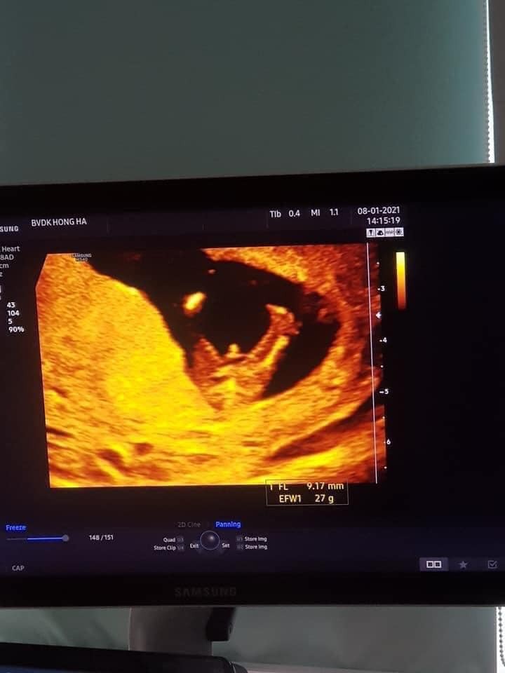 Nhìn ảnh khoe cờ him này buồn cười quá các mom ak🤣