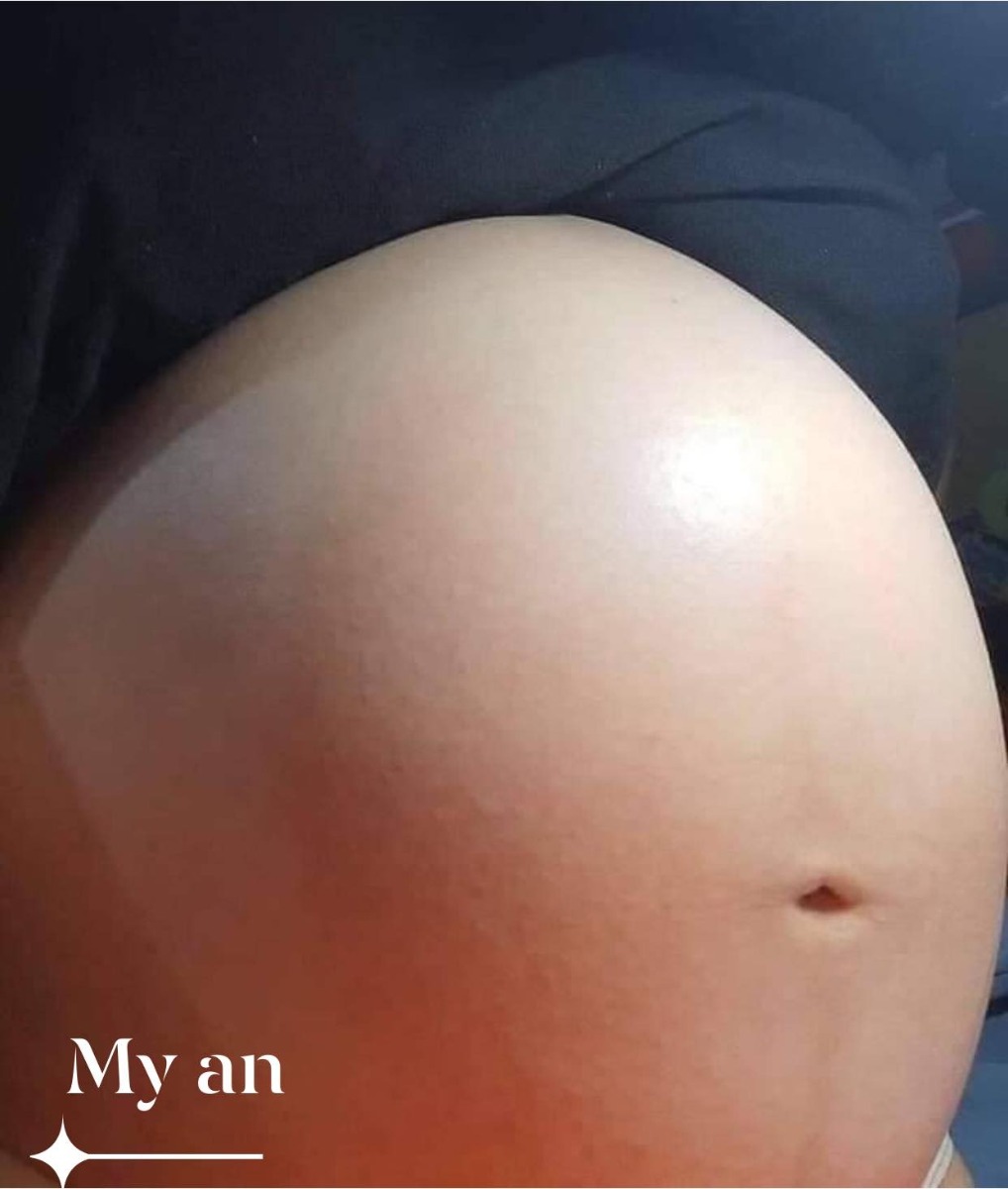 E Sắp hoàn thành nhiệm vụ rồi các mom ah
1 bạn trâu đực và 1 bạn trâu cái😅
Em  34w rồi ạ. Mỗi bé được 2500g và 2655g 
Bsi bảo trộm vía thai đôi mà to hơn cả thai 1🥰
Tặng vía  cho các mẹ nè