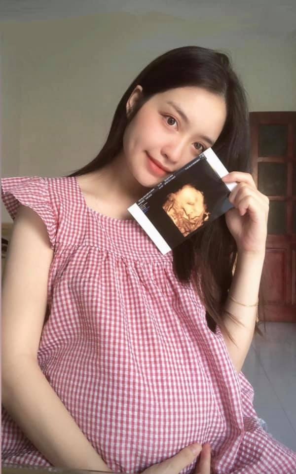 Nghiện thai giáo quá các mẹ ơi 🥰🥰
Nay đi siêu âm để gặp em . Em được 33 tuần rồi các mẹ ạ . Trâu zai nặng 2,5 kg . Mẹ lên 7 kg đến thời điểm hiện tại 😊 bs siêu âm con cười có má lúm giống mẹ con rồi ạ .
Con không cho mẹ uống sữa bầu , cứ uống là nôn ra hết sạch . Tv em bé lần nào đi siêu âm bs cũng khen vượt tiêu chuẩn . Mẹ thấy có sữa non từ 25t rồi ạ , mong sao sau sinh nhiều sữa như các mẹ
Cho các mẹ vía bé trai mạnh khỏe có má lúm nhà em nha 🥰🥰