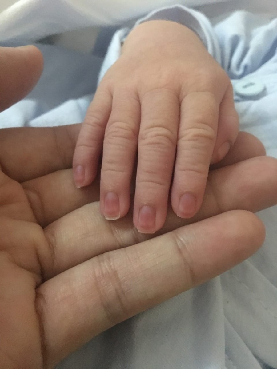 ❤️ LỜI CẢM ƠN❤️
Lời đầu tiên e rất biết ơn tới đội ngũ, các bác sỹ ,điều dưỡng khoa sản viện 103

Đây là quá trình đi sinh của em

Lần 1 đến ngày dự sinh rồi vẫn chưa có dấu hiệu gì để sinh cả lên BV khám bs bảo về theo dõi thêm tuần nữa, còn đau lúc nào xuống lúc đấy, lại xách mông về

Lần 2 quá ngày dự sinh 9 ngày vẫn tung tăng xe máy lượn đi làm, chiều 3h làm xong hết công việc đi lên BV khám lại lần nữa bs bảo vẫn như hôm nọ chưa thấy gì khác hơn, bs khám xong rồi bảo đi siêu âm thì bs bảo tim thai tốt, nước ối chỉ có hơi gợn xíu thôi không vấn đề gì
Khám và siêu âm xong bs bảo bây giờ e về nhà cũng được hoặc an toàn hơn thì ở lại BV để bs kiểm tra chứ thai già ngày rồi để lâu cũng không tốt, thế là hành trang nhập viện theo sự chỉ dẫn của bs

Trong quá trình nhập viện e may mắn vì được cả khoa sản chăm sóc luôn các mom ạh, vì ca của em hơi khó sinh hiii và đây là lần đầu e xa nhà và sinh con ở thành phố mà thấy ấm áp vô cùng

E cảm ơn bs tuyên, bs hải, bs linh với mấy bs nữa không nhớ tên luôn hỏi thăm động viên, dặn dò, cái này không phải 1 mình em được hỏi thăm đâu nha mà là tất cả các sản phụ sinh ở 103 luôn ( chưa thấy bs ở đâu nhiệt tình nhẹ nhàng như khoa sản ở 103 hết) các mom sinh sau không cần phải chọn bs làm gì cả vì tất cả bs khoa sản bác nào cũng nhẹ nhàng và có tâm, nên các mom cứ yên tâm chỉ cần xách bụng đi sinh thôi.còn lại cứ để các bs lo

Em cảm ơn các y bác sỹ trong kíp trực và cô thủy đỡ đẻ trực tiếp cho cháu nhờ bàn tay các cô , các bác mà ca khó sinh của mẹ con cháu được mẹ tròn con vuông

E cảm ơn c BinChuối Nhung người không quen biết gì với e mà c hướng dẫn, động viên, hỏi thăm, đưa đón như người nhà (lúc đầu ck em còn bảo bạn e hay e thuê c để chăm sóc.kaaa )
Các chị em đến sinh sau mà c ấy nhiệt tình thì đừng nghi ngờ gì nha, c ấy luôn nhiệt tình và nhẹ nhàng lắm ạ

CÒN VỀ CHI PHÍ CỰC RẺ
viện phí trái tuyến hết 1,6tr
XN covi 238k/ người
Đi sinh thì có gói đẻ sạch của bv 500k đầy đủ,các mom nên sử dụng tiện cho người chăm sóc
Tiền dường 200k cho người nhà
Cảm ơn bác sỹ tùy tâm

VẬT CHẤT
Phòng thì thoáng, sạch sẽ, mới tình
Nhà vs có nước nóng lạnh

ĂN UỐNG
3 bữa thay đổi đa dạng cơm canh nóng hổi, ăn ngon miệng

Anh ck Em bảo sau thêm cô con gái nữa vô đây sinh vì ekip toàn người trẻ mà còn tận tình, chủ đáo, tâm lý

e tranh thủ chút xíu lên cảm ơn các y bác sỹ, chúc các bác luôn khoẻ mạnh để nâng niu các thiên thần nhỏ bé mẹ tròn con vuông❤️