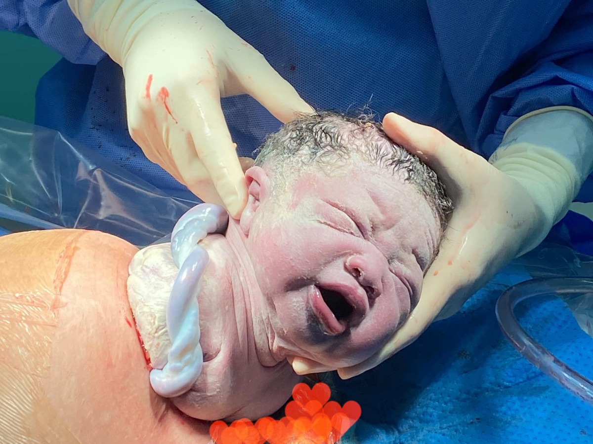 Em bé của Mẹ tiểu đường thai kỳ đây ạ! Em sinh ở tuần 38w mổ chủ động đc 3.6kg.

Mẹ dung nạp chỉ số cao ngất 5.3-12.2-10 lúc thai 26w.
Về nhà mua máy test tự kiểm soát ăn uống. Lâu lâu vẫn vượt. Đường đói dao động 5.0-5.8 liên tục. Sau ăn có hôm thả mồm đi chơi xa lên tận 8-9.

Tuần cuối cùng em chẳng đo nữa vẫn ăn kiêng nhưng thỉnh thoảng thèm quá vẫn ăn 2-3 quả vải, bánh kem, bánh trứng bông lan... trong bữa phụ. 

Các mom cứ để tinh thần thoải mái đừng stress quá. Tin vào bản thân và tin vào con. Miễn đừng quá nuông chiều bản thân ăn thả ga kg kiêng cữ là sẽ ổn hết. Phải có lí do con mới có mặt trên đời, và nhất định các con sẽ chào đời khoẻ mạnh bình an!

Cầu chúc tất cả các Mom sẽ đc ẵm con trên tay, các con của chúng ta sẽ khoẻ mạnh bình an suốt cả cuộc đời. Chúc tất cả chúng ta thoát được tiểu đường tuýp 2✊