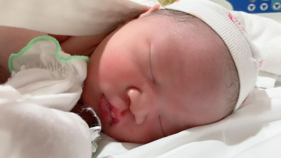 Trải qua 2 lần sinh và đều lựa chọn Việt Pháp là nơi chào đón các bạn nhỏ, nên hôm nay mình ngoi lên review về viện cho mẹ nào còn đang lăn tăn lựa chọn nhé 😉

Hồi sinh Mimi, từ 6-7w là mình đã đi khám qua kha khá bệnh viện để lựa chọn theo dõi, và khi bước chân vào VP, thì đúng như câu yêu ngay từ cái nhìn đầu tiên 😆 thiện cảm từ bảo vệ đến bác sĩ, ai ai cũng đều nhiệt tình, vui vẻ. Lúc đó viện mới chuyển sang toà nhà mới nên cái gì nhìn cũng sạch đẹp xịn xò. Nên chốt luôn không suy nghĩ. 

Đến lúc bầu Đô Đô được 6w, mình cũng lại vào viện khám. Và đáng yêu hơn là mình được khám miễn phí lần đó (mặc dù lúc đó chưa mua gói) ❤️

Cả 2 lần bầu mình đều đăng ký gói theo dõi từ 12w, và đều được khám sớm từ 7-8w. Và cả 2 lần mình đều theo bác sĩ Nghị siêu nhẹ nhàng & tình cảm. Lần nào siêu âm xong cũng được bác lau hộ gel siêu âm. Bởi lẽ với 1 bà bầu bụng to chềnh ềnh, lau hết đống gel đấy khá khó khăn, nên lúc nào cũng được bác làm giúp. Ngoài ra mình thấy các bsi ở VP cực biết ý khi siêu âm cho sản phụ, các bác sẽ chỉ để đèn phía gần cửa ra vào và kéo rèm che để trong phòng chỉ hơi mờ mờ, cho sản phụ đỡ ngại ngùng ☺️

Trong cả quá trình theo dõi thai, bất kỳ lúc nào mình k yên tâm hoặc có vấn đề gì khác lạ, mình đều đặt lịch khám thêm ngoài lịch hẹn với bsi, và 1-2 lần khám cấp cứu, và đều không bị phát sinh chi phí gì.
Hôm sinh, thật ra cũng chỉ là 1 lần đến khám ngoài giờ cho yên tâm, vì cả 2 bạn mình đều có cơn gò từ khá sớm. Trên đường ra viện còn lỡ mồm hỏi chồng nhỡ nay đẻ luôn thì sao nhỉ. Và y như rằng, vào khám cơn gò đã dầy, bsi yêu cầu mổ luôn 🤣🤣, vậy là chẳng kịp xem ngày xem giờ gì hết 😂 

Sau đó mình được đưa về phòng, vì là thời điểm dịch nên viện sắp xếp mỗi sản phụ một phòng, nên mặc dù là phòng đôi, nhưng cũng chỉ có mình mình ở, rộng thênh thang. Mình được phát áo mổ & đi tắm sát khuẩn. Trong viện đã chuẩn bị đầy đủ đồ vệ sinh cá nhân từ bàn chải, dầu gội, sữa tắm,... đến bỉm mẹ bỉm con, bvs,... nên các bạn chẳng phải mang gì ngoài cái bụng bầu và một tâm hồn đẹp cả 😆

Nghe đồn phòng mổ VP đẹp lắm, như phim hàn xẻng. Nhưng với đứa cận lòi như mình, mặc dù vào đến 2 lần, nhg đều chẳng chiêm ngưỡng được độ đẹp của nó 😢 chỉ thấy mờ mờ là ờ, cũng sáng đó, rộng đó, còn lại chả rõ cái moẹ gì. Phòng mổ vô trùng nên rất lạnh nhé, nhưng yên tâm ở VP các bạn sẽ được đắp chăn ấm, và được luồn ống sưởi vào chăn ạ. Các bác sĩ y tá phòng mổ cũng rất vui vẻ, vừa làm vừa buôn đủ thứ chuyện với mình, cho mình đỡ căng thẳng. Gây tê thì cực nhẹ nhàng, mình chỉ bị nhói 1 cái lúc chọc kim thôi. Sau đó là nửa thân dưới bắt đầu tê và mất cảm giác. Lần này mình mổ cấp cứu bác Hằng. Ban đầu mình cũng định gọi bác Nghị mà mình theo dõi từ đầu mổ cho mình, nhg nghe được y tá bảo bác mới trực cả đêm qua với hôm nay, nên lúc đó mình lại thôi. Nhưng bác Hằng mổ cũng khá ok, trừ việc lúc khâu bác để thành 2 đoạn chỉ, làm hôm đi rút chỉ mình khá đau, mà còn phải chịu tận 2 lần 😢

Sau khi bác sĩ vào thì bắt đầu mổ, mình được chắn tấm chắn ở trc mặt nên chẳng nhìn thấy gì, chỉ nghe tiếng dao, tiếng hút, rồi bắt đầu lôi lôi kéo kéo 1 lúc thì bỗng nhẹ bẫng cả bụng, tiếng thằng con ré lên. Cuối cùng cũng xong 😌

Em bé được hút dịch, lau gây rồi được hộ sinh bế ra cho mẹ nhìn mặt. Nhưng khổ nỗi con mẹ cận lòi, chưa nhìn rõ mặt con, các cô đã bế đi chăm sóc sơ sinh luôn rồi 😂 Sau khi bé được vệ sinh, kiểm tra thì được đẩy về phòng gặp bố. Nhưng do dịch nên bố không được bế em, không được tiếp da, chỉ được nhìn 1 lát là bị các cô mời về. Còn em bé sẽ được đưa về phòng sơ sinh nằm lồng.

Sau khi đưa em bé ra, việc còn lại là vệ sinh & khâu, mất khoảng 1 tiếng thì mình được đẩy về hậu phẫu theo dõi 2 tiếng. Vì mình mổ nửa đêm nên lúc mổ mình buồn ngủ lắm luôn, vừa nằm mổ vừa ngủ gật mất mấy lần 🤣 nhg đến lúc về hậu phẫu thì lại mong ngóng con chẳng ngủ được. Đến 2h sáng thì mình được về phòng, tiếp da và cho con ti mẹ. Trong đêm đầu tiên đấy, khoảng 30p-1 tiếng hộ sinh lại vào để kiểm tra sản dịch, huyết áp và truyền thuốc.

Và mặc dù sinh mổ nhưng mình k hề đau. Nghe mng bảo mổ lần 2 đau hơn lần 1 nhưng cá nhân mình thấy cả 2 lần đều k đau, lần 2 mình còn cảm thấy k đau bằng lần 1. Sau khi rút ống thông tiểu là mình đi lại đc rồi, chỉ có lúc mới đi đấy thì hơi đau chút, còn sau đó thì đi lại phăm phăm, đứng lên ngồi xuống cũng khá nhẹ nhàng. Ở VP mới có tiêm giảm đau cơ vuông khi mổ, nhg mình không dky ạ.

4 ngày lưu viện, mặc dù ở 1 mình và người nhà không được vào, nhưng mọi việc đều được các chị hộ sinh chăm sóc cẩn thận. Bất kì việc gì đều có thể gọi nhờ các chị, từ chị ơi, đỡ em vào phòng tắm, đến chị ơi, thay bỉm cho bé hộ em, lấy cho em bình sữa cho bé, trông bé giúp em,...

Ở VP,  các bé được ưu tiên sữa mẹ hơn cả. Các mẹ được khuyến khích kích sữa và chờ cho con ti sữa non. Nếu gửi bé cho các cô chăm, các cô đều sẽ hỏi bé ti mẹ hay ti sct, nếu bé khóc đòi ăn thì các cô sẽ đưa về cho bé ti mẹ. Mẹ còn được hướng dẫn cách massage gọi sữa, chỉnh khớp ngậm cho bé, hướng dẫn cách tắm & vệ sinh cho bé.

Ngoài ra ở VP còn có phòng hút sữa cực xịn xò, đầy đủ từ máy hút sữa, đèn hồng ngoại, máy tiệt trùng uv, máy hâm sữa đến máy rửa bình, tủ trữ sữa mẹ. Nhờ mấy ngày ở viện tích cực chiếu đèn hồng ngoại và kích sữa, trộm vía sữa về nhanh hơn nhiều. 

Hôm ra viện, mọi thủ tục ra viện đều được các chị lễ tân làm từ a-z, hoàn thiện thủ tục mình chỉ việc ra ký giấy tờ và có thể xuất viện về nhà. Do dịch nên khi xuất viện người nhà cũng chỉ được đỗ xe dưới sảnh đón, nên mình sẽ được ngồi xe đẩy và đưa xuống tận xe. 

Về chi phí sinh ở VP, thì mình đky gói theo dõi từ 12w sinh thường là 46tr900, mình được giảm 3tr là còn 43tr900. Tuy nhiên mình là đẻ mổ nên hôm nhập viện phải thanh toán thêm 15tr300. Ngoài ra phát sinh thêm 1 số chi phí thuốc cho mẹ và 2 mũi tiêm lao, vgb cho bé, tổng phát sinh thêm khoảng 5triệu. 

Trước bầu mình có mua bảo hiểm thai sản, được thanh toán khá nhiều ~ 43triệu. Nên tính ra khá là lợi 😇

Túm lại, trải nghiệm 2 lần sinh tại VP thật sự là xứng đáng. Nhg hy vọng sẽ không có lần thứ 3 🤣🤣🤣