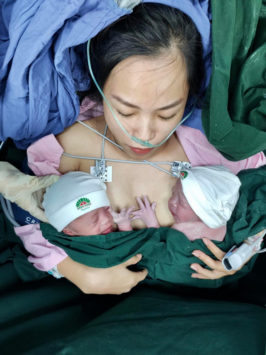 REVIEW ĐẺ MỔ BV HỒNG NGỌC - PHÚC TRƯỜNG MINH 😎

Mình đẻ từ 4/7. Nay mới ngoi lên kể lể chút về trải nghiệm đi đẻ ở đây 😂

Mình là thai đôi, đăng ký gói 36w đẻ mổ lần 1 - giá trong gói là 48,5tr - được giảm 10% vì đky nhóm 3 mẹ còn 43,650tr. Tập 1 là đẻ thường nên chưa có kinh nghiệm đẻ mổ phát nào nên đến ngày mổ cũng có chút lo lắng.

Mình đky khám và mổ bsy Tú. Trước ngày mổ 1 ngày bệnh viện sẽ gọi điện hẹn 11h trưa hôm sau. Dặn dò về vấn đề nhịn ăn uống, vào sớm trước 2 tiếng và giấy tờ, đồ đạc cần mang theo.

Đến hẹn m vào viện. Khám, siêu âm và chạy máy lần cuối. Trong lúc này người nhà đi nộp giấy tờ và làm thủ tục nhận phòng. Đợt này đang khuyến mãi nên các mẹ auto đều có phòng riêng. Vì nhà m sinh đôi nên up lên phòng Deluxe cho rộng, phát sinh thêm 1,250tr x 3 đêm.

Chạy máy xong thì các cô hộ lý sẽ thụt cho mẹ rồi phát quần áo, bỉm, giày dép để mẹ thay ạ. Hôm m đi mổ chắc ngày đẹp nên khá đông. Vào phòng hậu phẫu truyền nước chờ đến lượt đẻ mà ngủ đc 1 giấc. Khoảng 11h40 thì các bạn đập dậy “Chị ơi đi đẻ thôi”

Vào phòng phẫu thật thấy bác Tú đang chờ sẵn, trông bác hơi mệt, bác bảo sáng nay mổ 4-5 ca gì đó, chiều lại chiến tiếp… Các bạn trong ekip bắt đầu tiến hành các bước: tiêm gây tê màng cứng, gắn các loại dây dợ. Lúc tiêm hơi nhói tý, tầm 5p sau mất dần cảm giác là bác Tú bắt đầu mổ. Trong quá trình mổ có 1 bạn đứng buôn chuyện với mình. Mổ thì ko có cảm giác gì, nhanh lắm ạ. Khoảng 12 đã thấy bụng rút dần và 1 bạn oe oe, 3 phút sau bạn còn lại cũng lộ diện. Các cô lau qua cho 2 bạn rồi cho da kề da với mẹ và hỗ trợ 2 bạn tu ti mẹ luôn. 

Cậu anh rất hợp tác nhưng cậu em còn chưa quen, nên sau đó dù khâu xong xuôi các cô vẫn cố hỗ trợ cậu em và để em tu ti mẹ đc ít nhất 15p 😂. Khâu xong bác Tú chúc mừng 3 mẹ con và các bạn trong ekip làm nốt các việc còn lại. Sau đó bé đc bế ra cho người nhà nhìn và đưa về p chăm sóc sau sinh, mẹ thì về phòng hậu phẫu nằm theo dõi 3 tiếng.

Mổ xong lạnh run thực sự ạ. Nhưng tầm 1 tiếng sau thì lại nóng vã mồ hôi nên m ngủ chập chờn. Có các bạn nhân viên thấy m tỉnh rồi ra ngồi buôn chuyện cùng. Mãi cũng hết 3 tiếng đc về phòng gặp con và gặp người nhà.

Mổ buổi trưa đến đêm thì thuốc giảm đau hết tác dụng, m bắt đầu thấy nhức dần. Nghĩ chịu được nên ko ấn nút gọi y tá. Mãi gần sau đau vã mồ hôi mới ấn chuông thì các bạn vào nhét thuốc cho… Nên các mẹ mổ đau thì cứ mạnh dạn ấn gọi cô hỗ trợ nhé. Bsy Tú cũng dặn là “em ko cần tiết kiệm thuốc cho bệnh viện thế đâu” 😂. Sáng hôm sau thì m thấy cũng đỡ rồi nên chỉ gọi nhét thuốc đúng 1 lần đó thôi.

Một ngày sẽ có cực kỳ nhiều lượt bsy, y tá, hộ lý, mang đồ ăn, dọn phòng vào để thăm khám, làm nhiệm vụ của họ các mẹ nhé. Bé sẽ được các cô tắm vào buổi sáng. Mẹ đc chiếu tia plasma 4 lần. Vết mổ gọn lắm ạ 🥰. 

 Về dịch vụ thì ko có gì để chê cả. Ngày 3 bữa chính 2 bữa phụ đa dạng, tuỳ các mom chọn. Người nhà thì lên tầng 4 ăn. Em update hình ảnh 1 vài bữa cơm ở viện ạ.