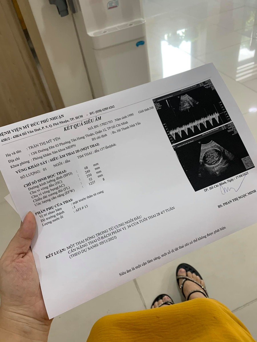 Đã hoàn thành mũi Vaccine Covid đầu tiên . 

-- Cảm thấy may mắn vì mình chọn được chổ tiêm sạch sẽ tiện nghi lại siêu vắng như vậy trong thời điểm này . 

Tuần trước thấy nhiều người đi tiêm ở ĐHYD rồi bv Hùng Vương mình cũng nôn nóng lắm , nhưng rồi bình tĩnh chờ đợi vì mấy bv đó rất đông sợ bị lây nhiễm chéo và đang bầu to ko đủ sức xếp hàng chờ đợi . 

❤ Rồi thấy được thông tin bv Mỹ Đức cho đăng kí chích cho các bạn bầu từ 13w trở lên mình đk liền , chờ đợi 2 ngày bên bv gọi lại và nhắn tin hẹn ngày chích . 

-- Quy trình chích ở đây cũng siêu đơn giản : nếu có giấy khám thai trong 1 tháng gần nhất thì ko cần khám lại , test nhanh Covid 300k và được chích thuốc Astra miễn phí . 

Đầu tiên tới khai báo y tế , sau đó test nhanh chờ 30p có kết quả sau đó trực tiếp lên lầu 4 để được tư vấn chích ( mình ghé lầu 1 để khám và siêu âm ) . 

-- Ko biết do mình là ca cuối chích hôm nay hay sao mà ko giai đoạn nào phải chờ số hết luôn , điền giấy xong được Bác sĩ tư vấn rồi đi thẳng qua chích - Mũi chích siêu nhẹ nhàng ko hề có cảm giác gì luôn . 
- Sau chích ngồi theo dõi cỡ 20p thì được đi đo tim thai lại dặn dò các thứ sau tiêm thì được về rồi ❤ 

Mình đánh giá bv Mỹ Đức cho chích đợt này 10/10 luôn , từ nhân viên tới y tá bác sĩ đều rất nhẹ nhàng từ tốn nhiệt tình thăm khám và tư vấn 

. Còn bệnh viện thì sạch sẽ tiện nghi , bánh kẹo đầy đủ cho mình ngồi chờ có ăn , có điều làm nhanh quá chưa kịp ăn gì :v 

Mấy bạn bầu trên 13w nhanh nhanh đăng kí chích cho kịp thuốc nghen